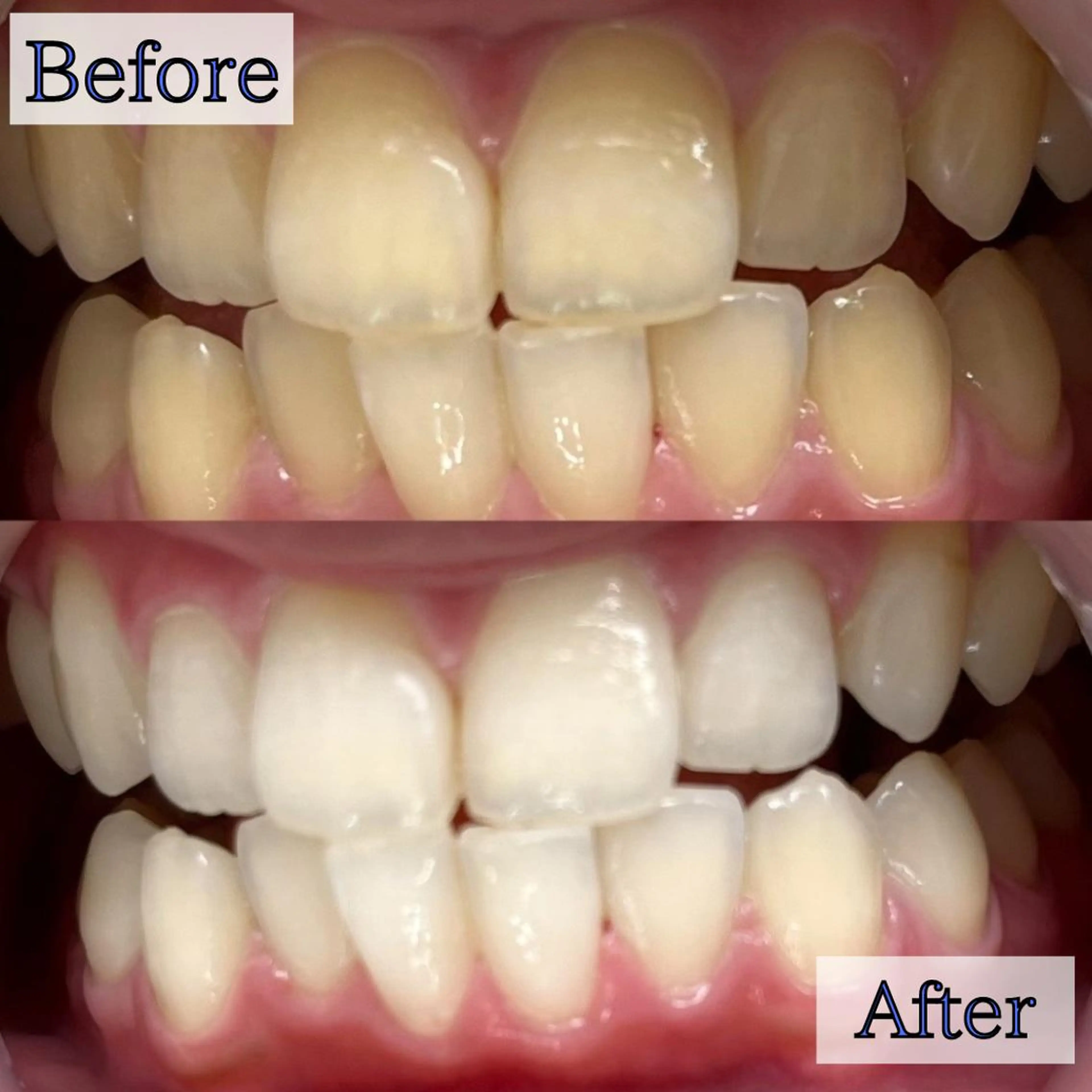 LBSホワイトニング 銀座店💎スタッフ峯のその他イメージ