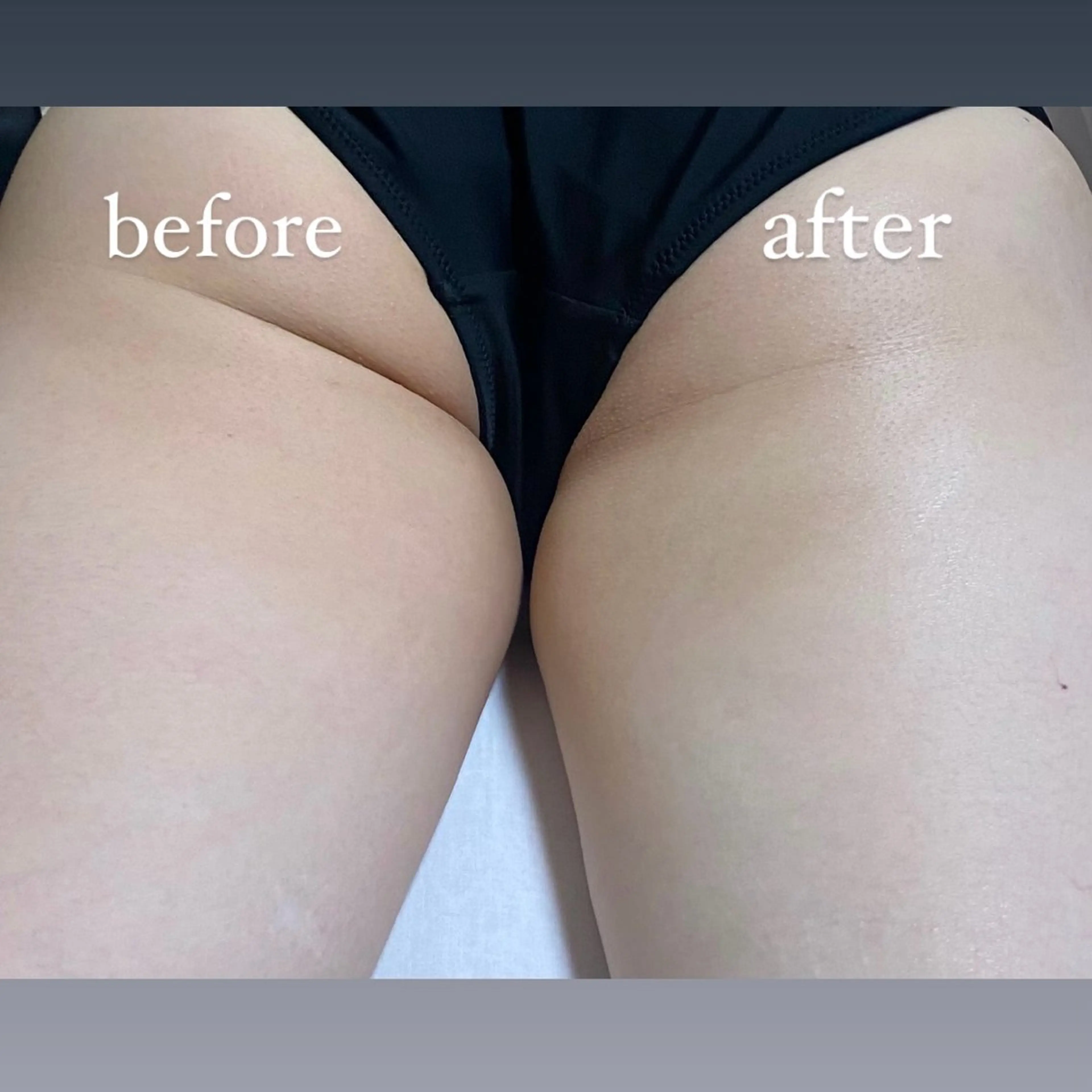 エステ リラク egg tea forêtのエステ・リラクイメージ