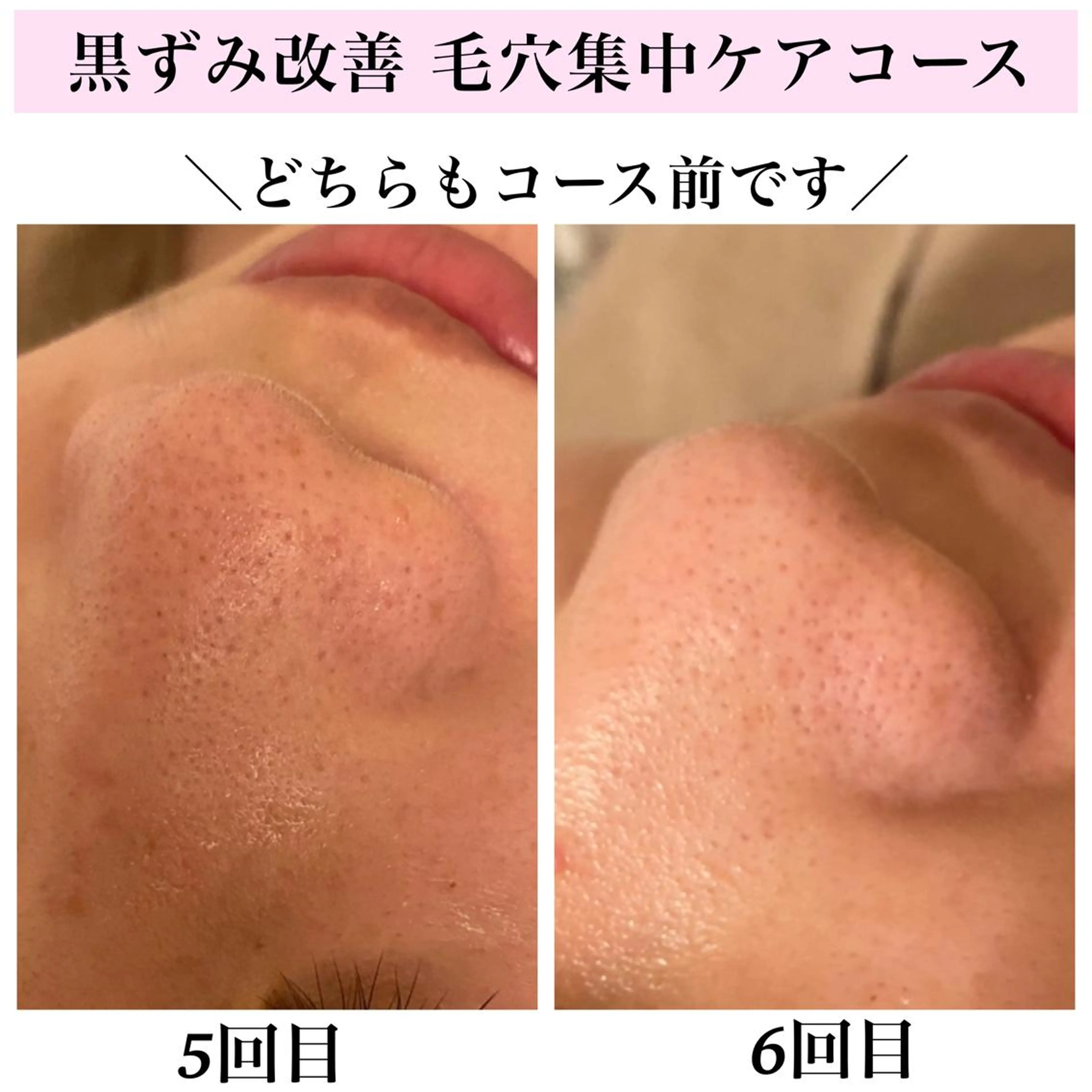 エステ リラク Bellesthe （ベルエステ）のエステ・リラクイメージ