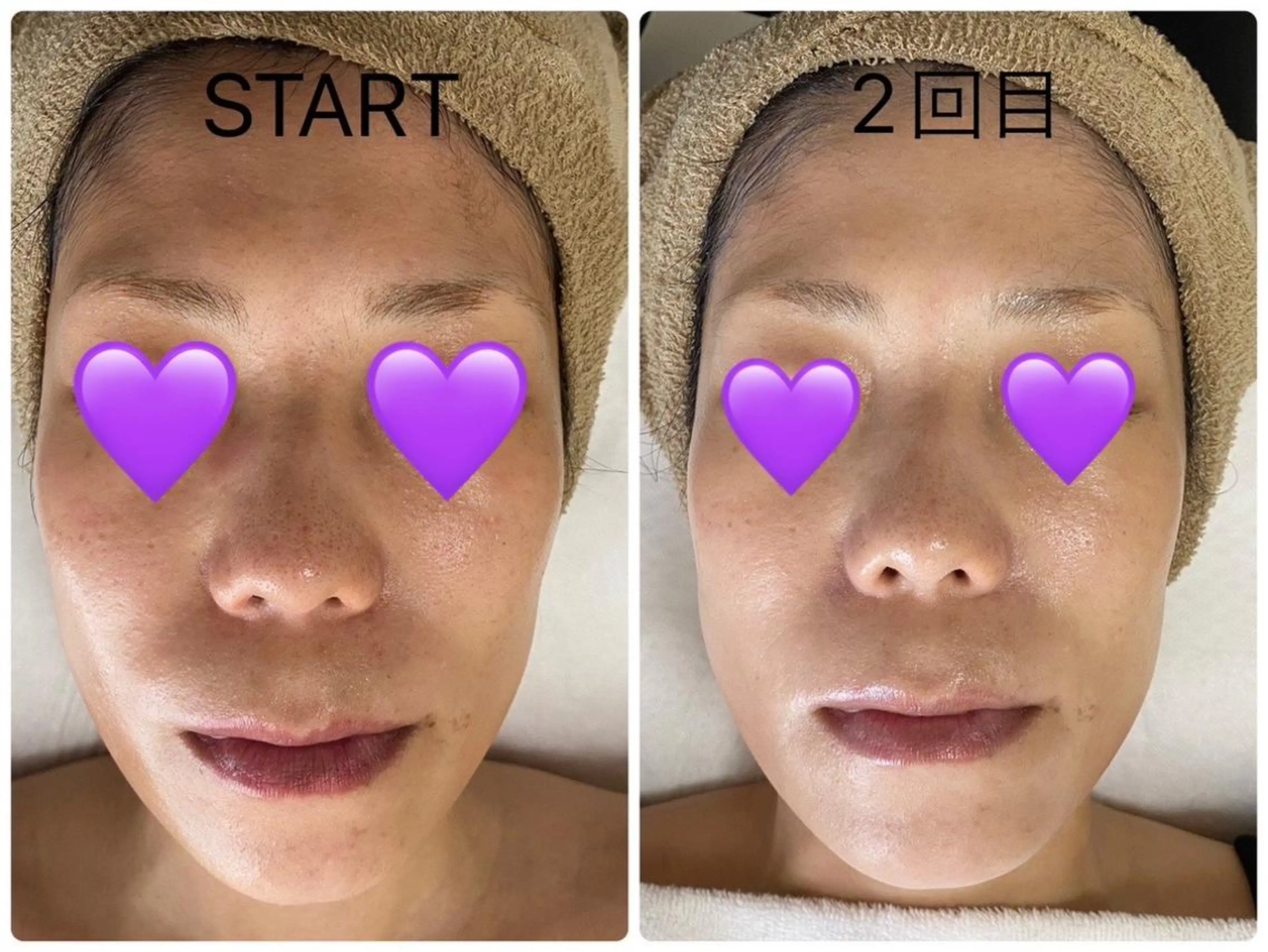 De I'm トータルビューティーサロン所属・COCO beautyサロンのエステ・リラクイメージ