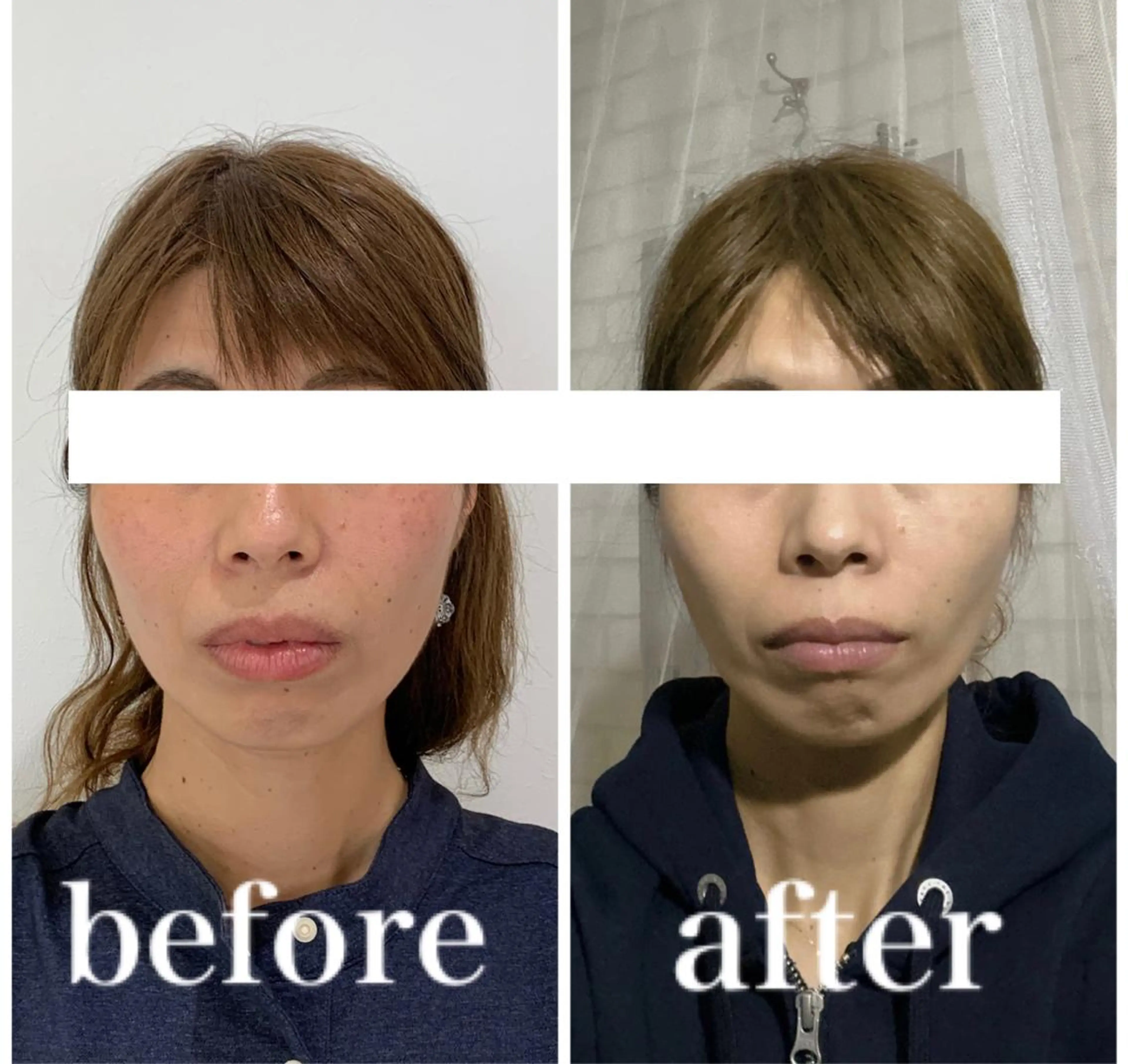 エステ リラク 小顔と ヘッドスパのお店のエステ・リラクイメージ