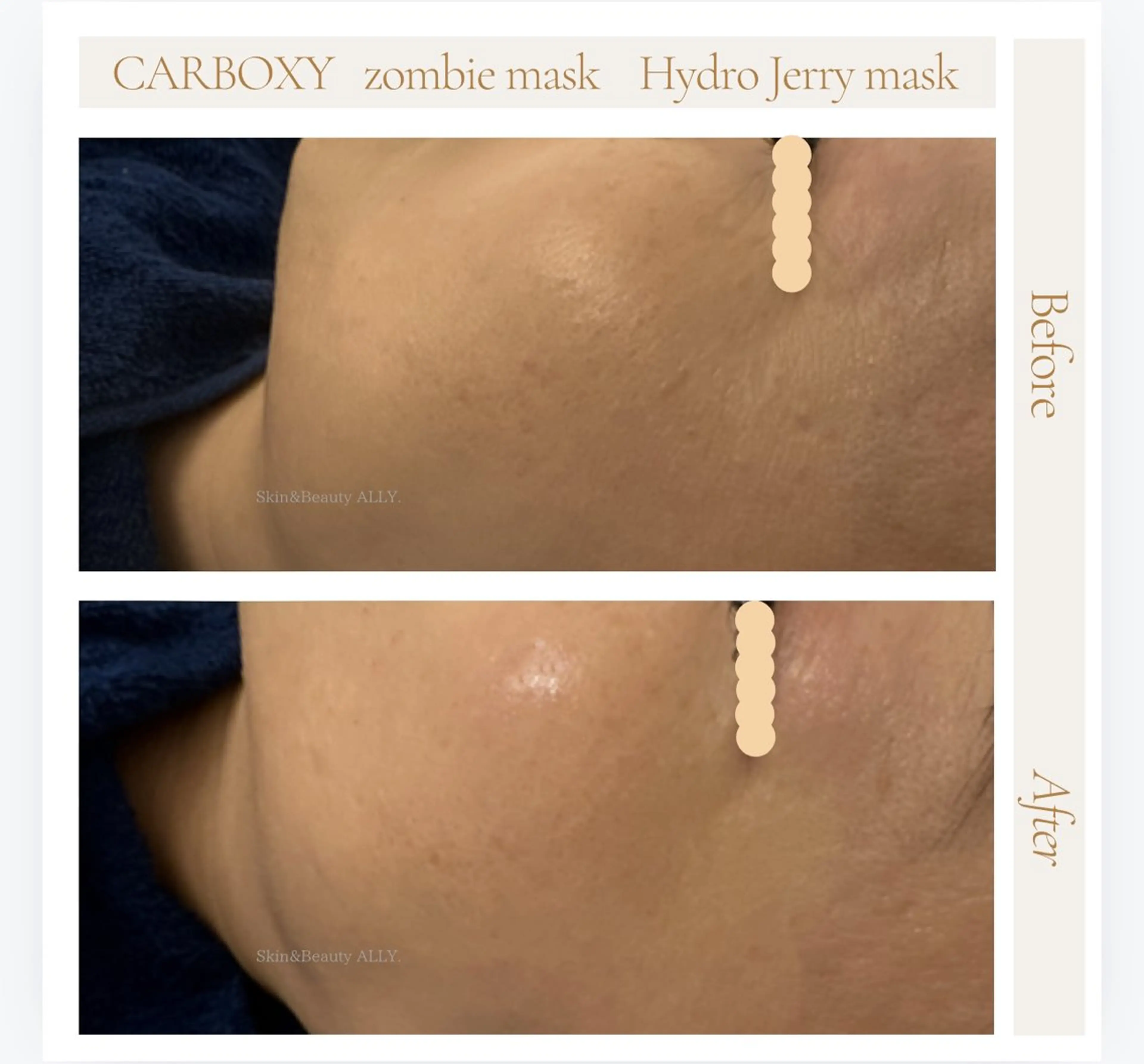 艶肌ワックス ALLY.のエステ・リラクイメージ