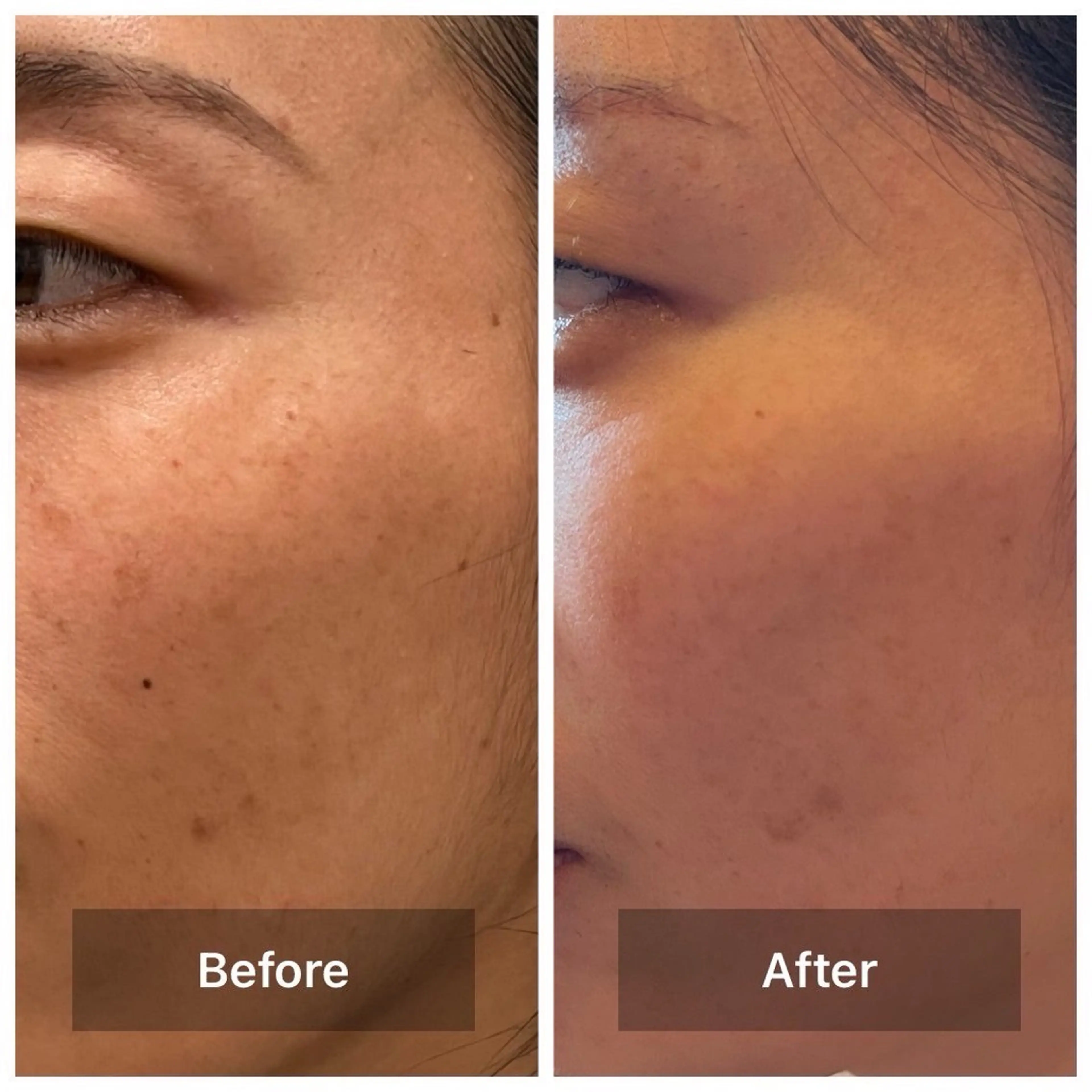 nature  s oin ICHIKAのエステ・リラクイメージ