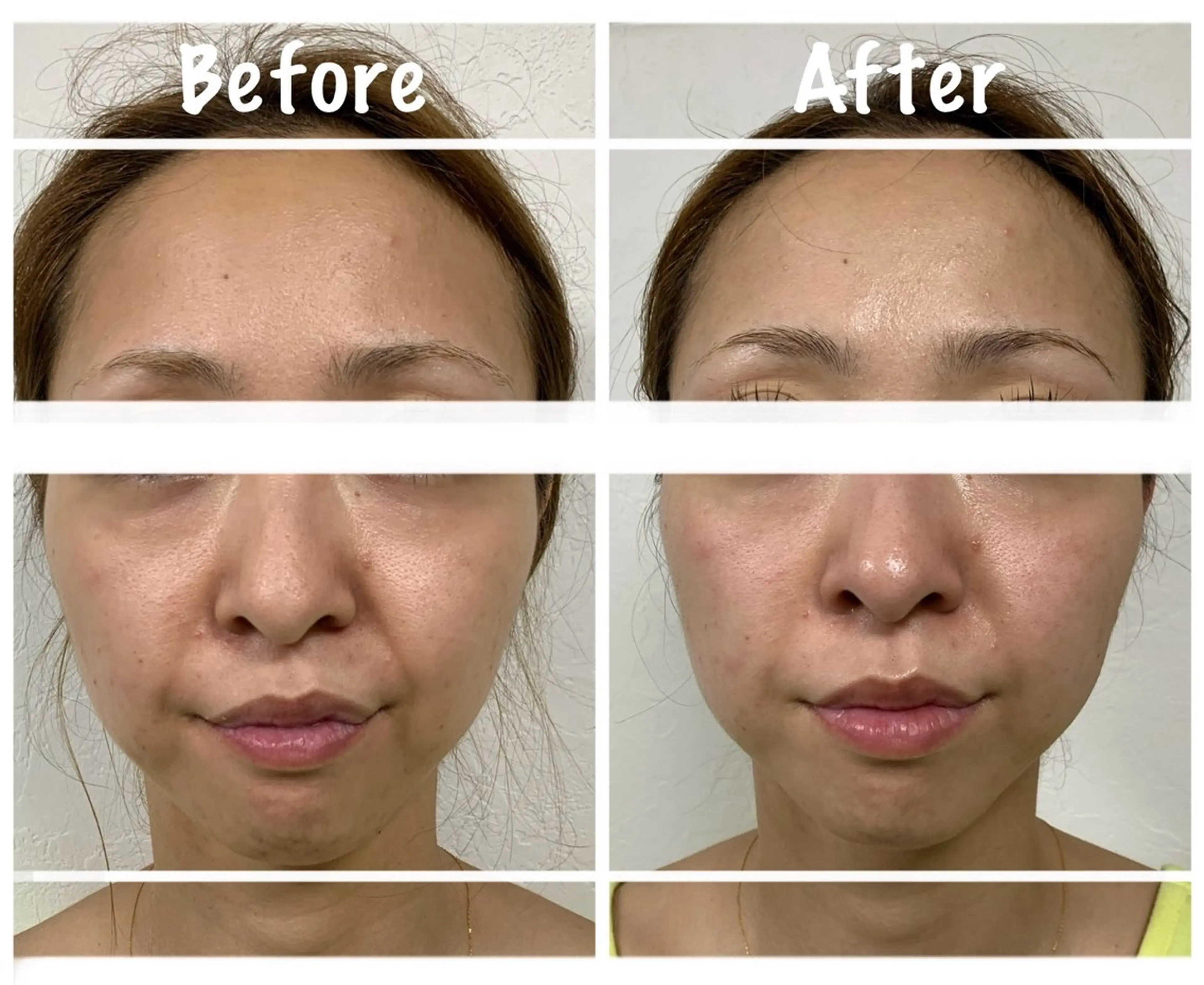 魔法のエイジングケアフェイシャル❤️たるみ・くすみ・むくみ・小顔・高保湿【当店フェイシャル人気No1】の写真