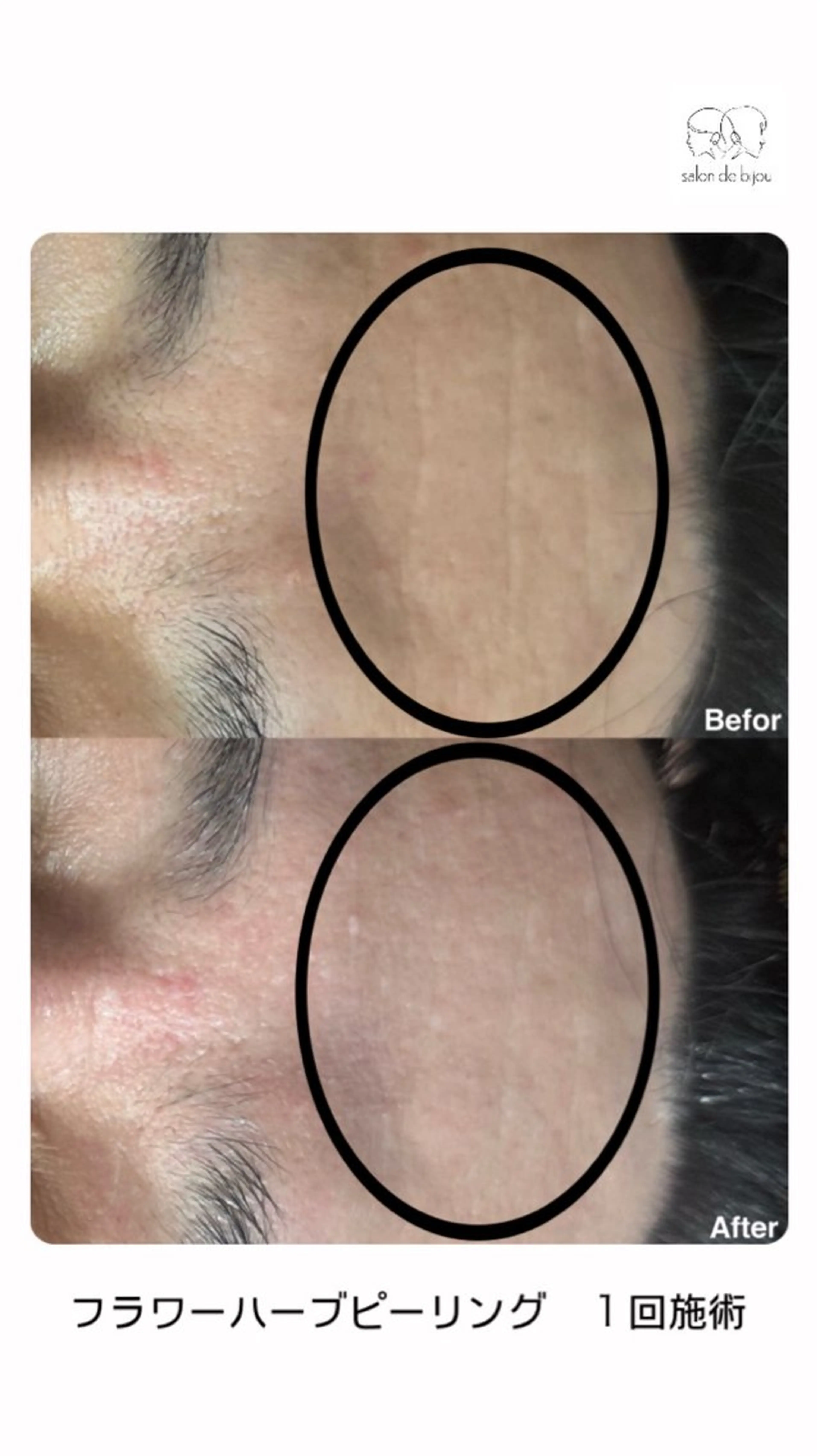 salon debijouのエステ・リラクイメージ