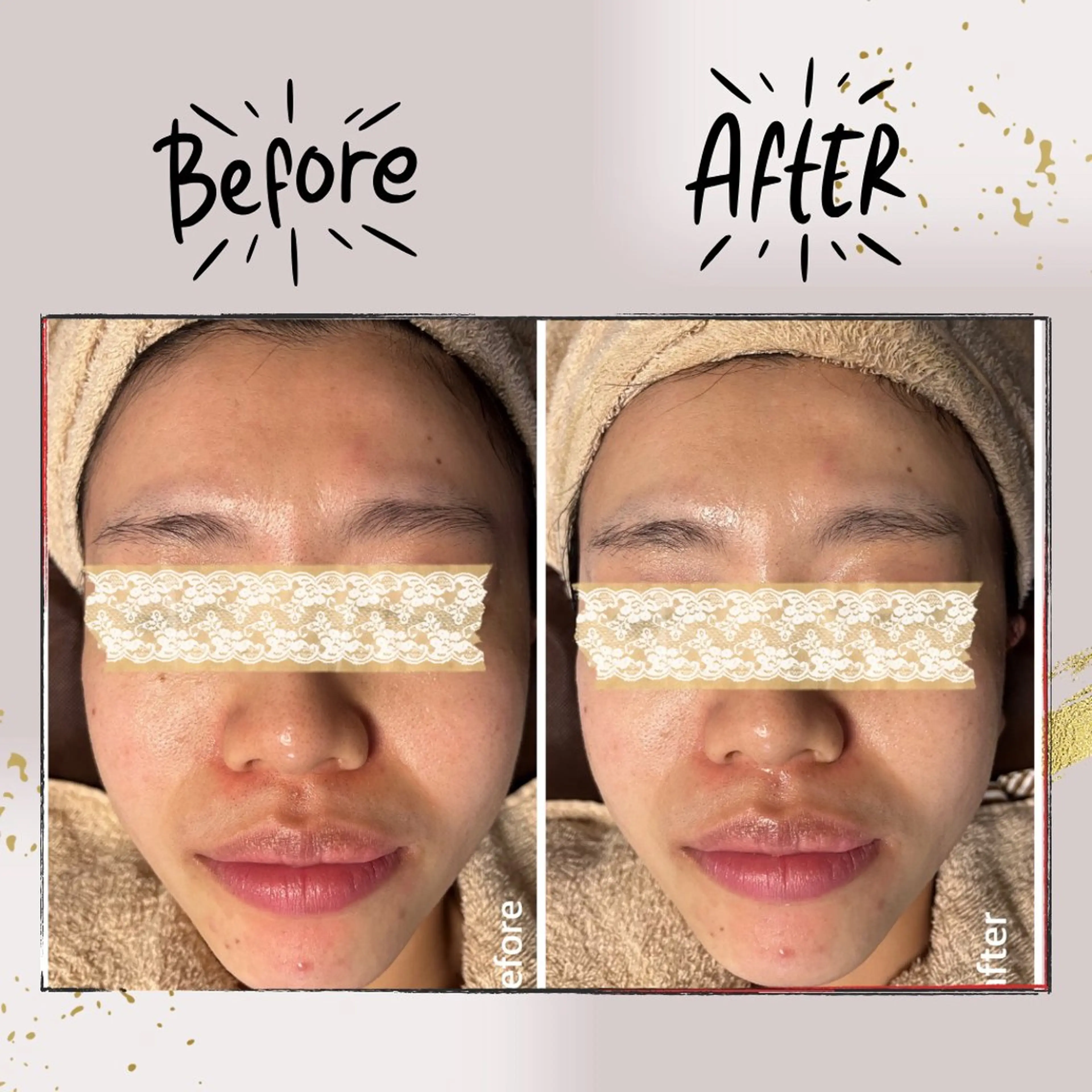 ピーリング専門店 Belluteのエステ・リラクイメージ