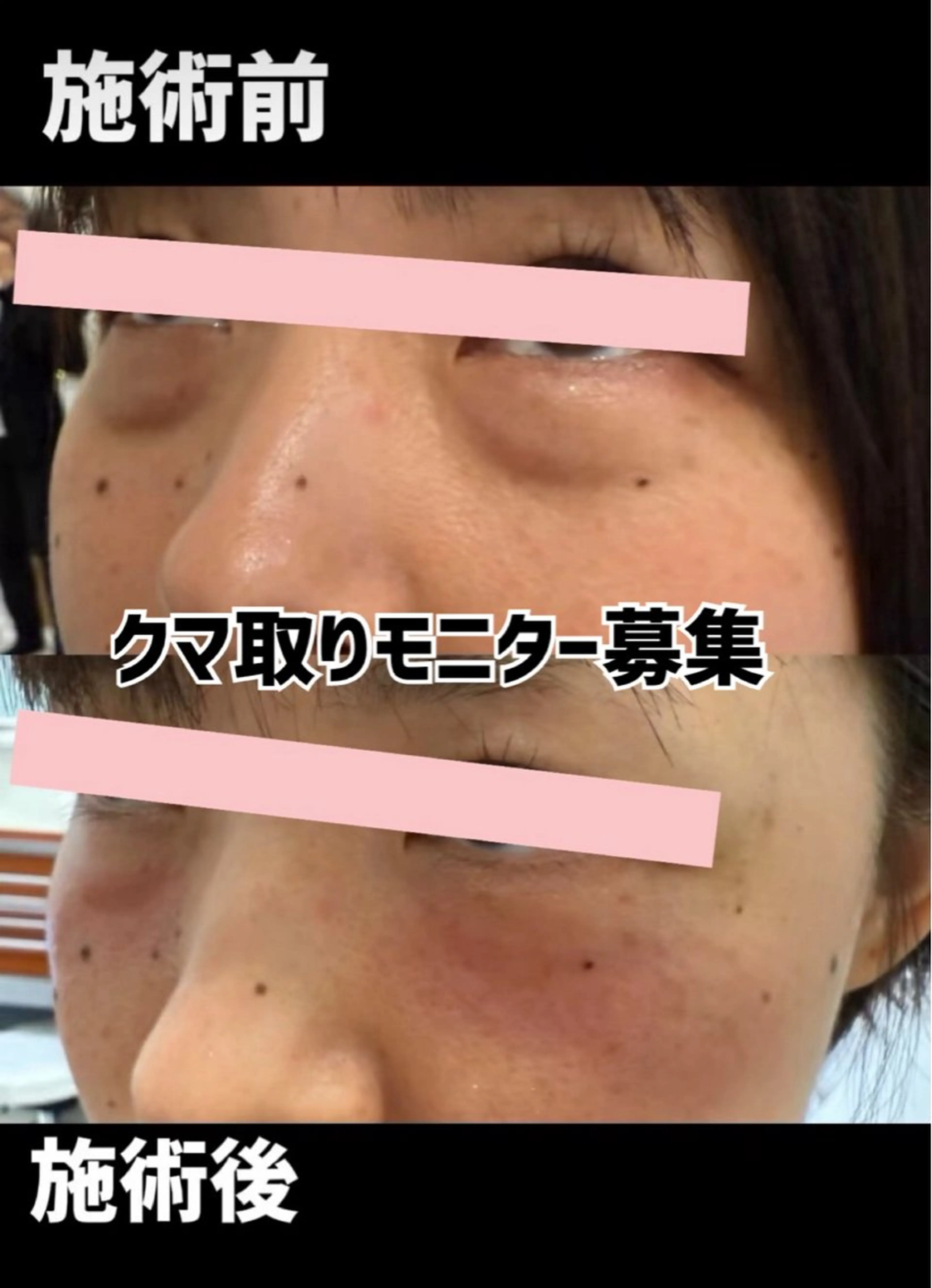 メンズ 美肌脱毛エステサロン Luangeのエステ・リラクイメージ