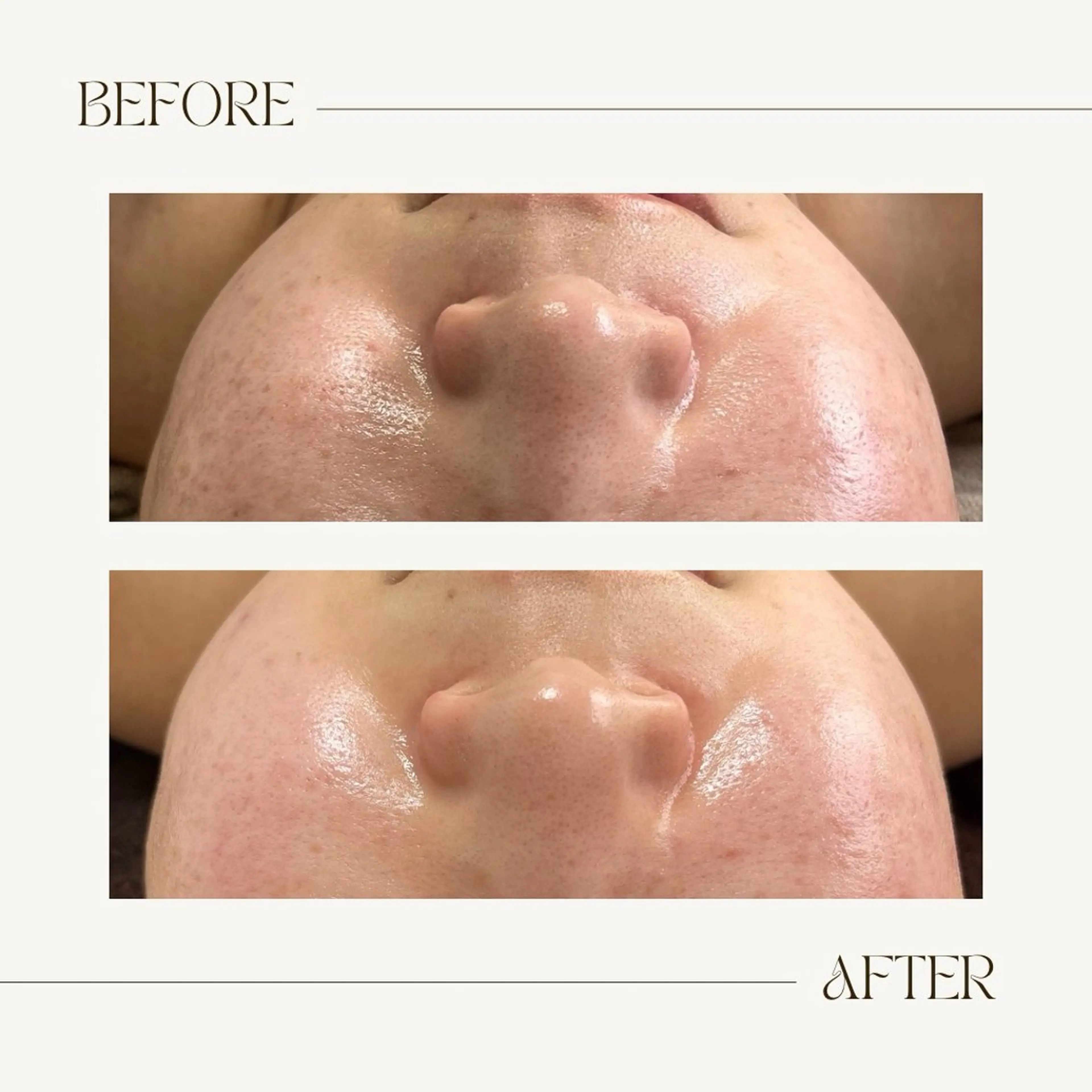 エステ 1st｜フェイシャル エステ専門店のエステ・リラクイメージ