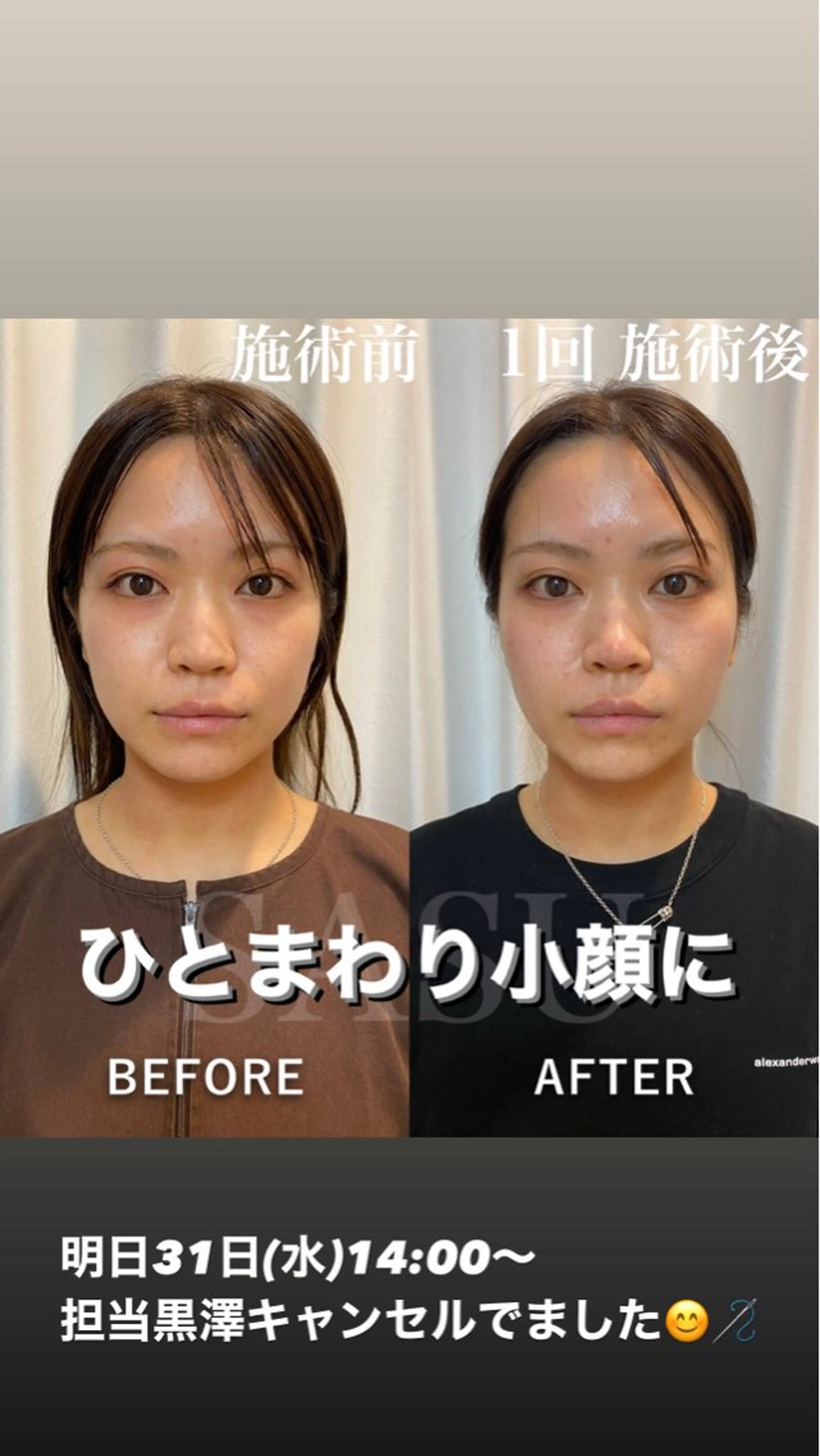 その他 鍼灸×ハーブピーリングサロンSASU所属・石井 稚乃のその他イメージ