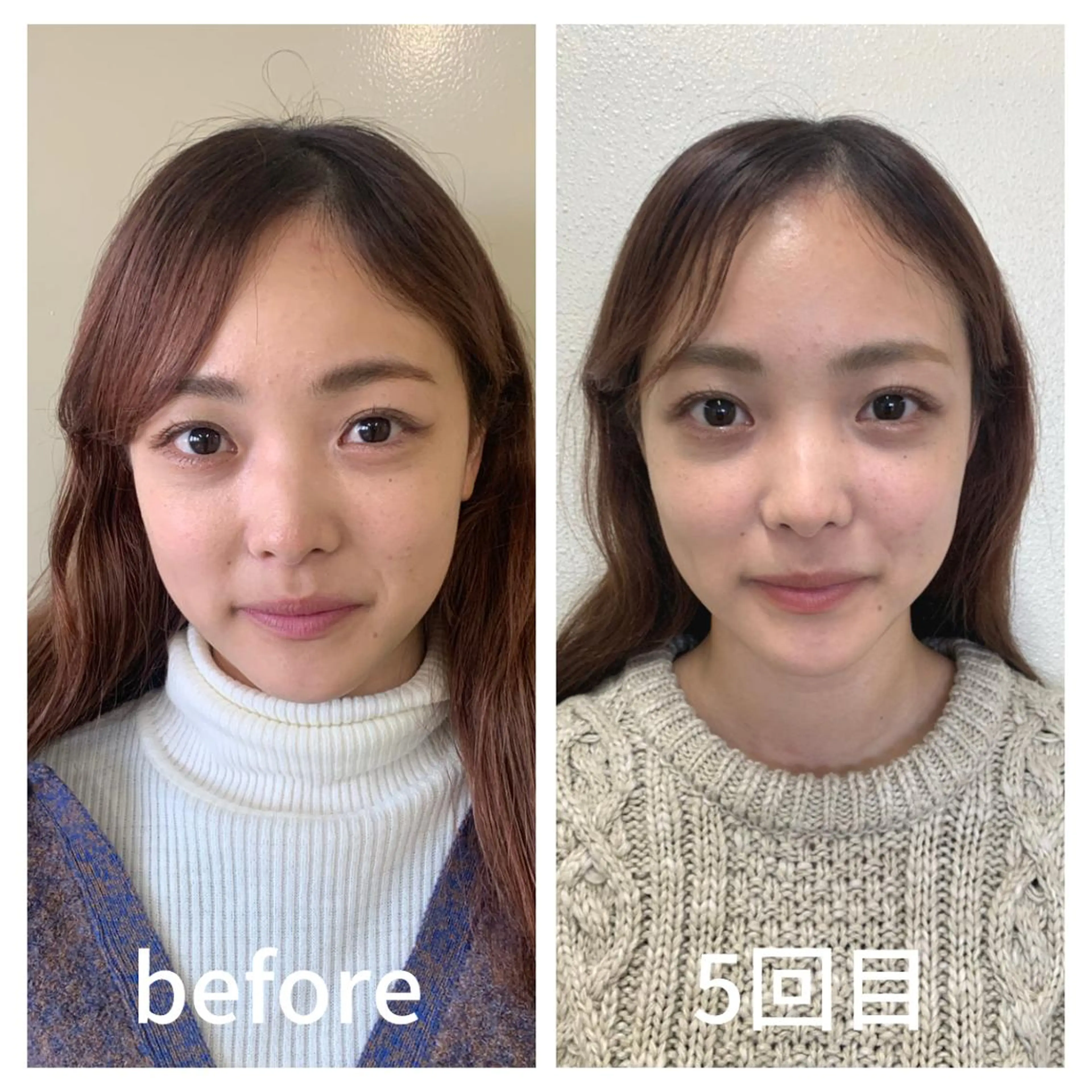 小顔サロン AMYONのエステ・リラクイメージ