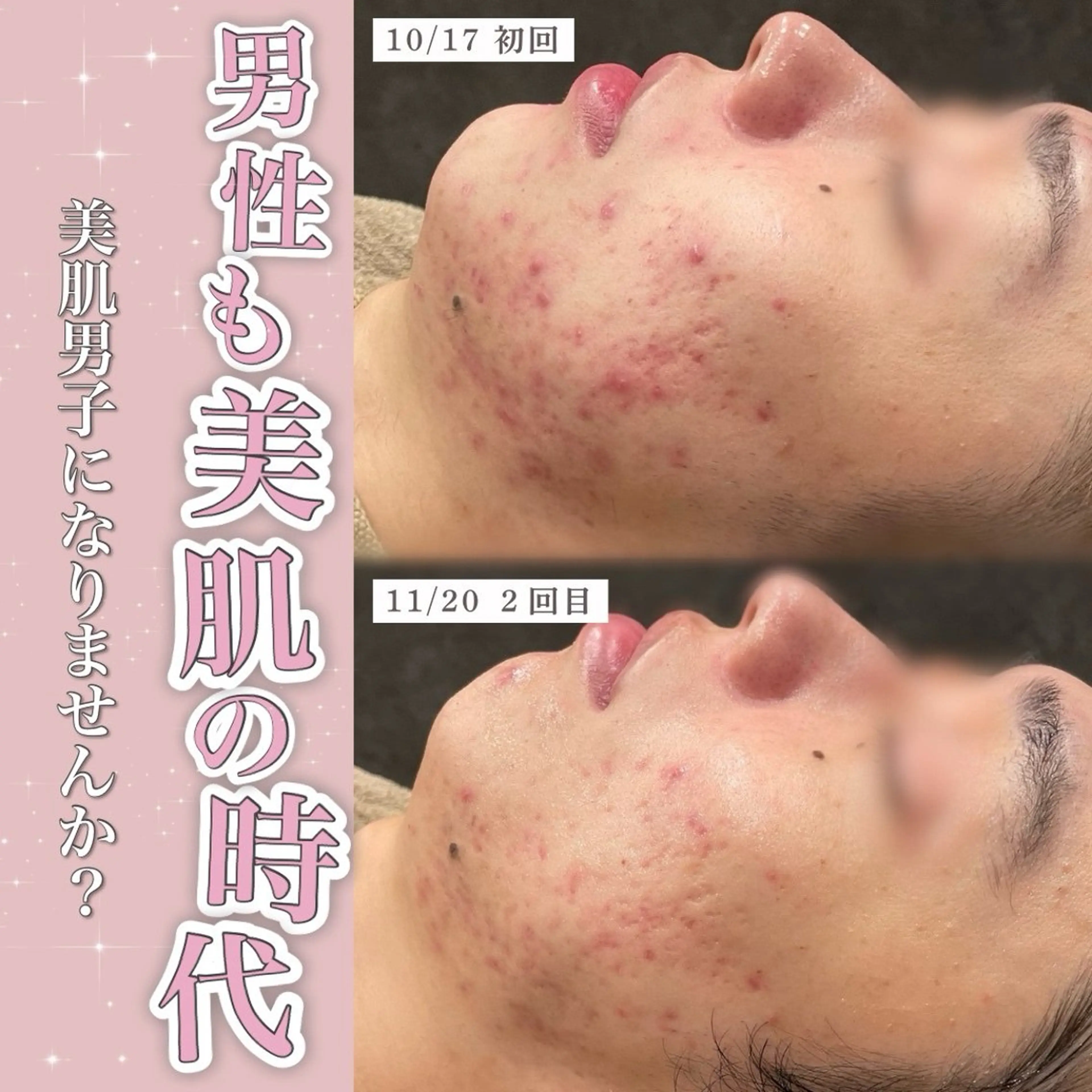 エステ Re:Belle所属・Re:Belle 久留米 : 中島のエステ・リラクイメージ