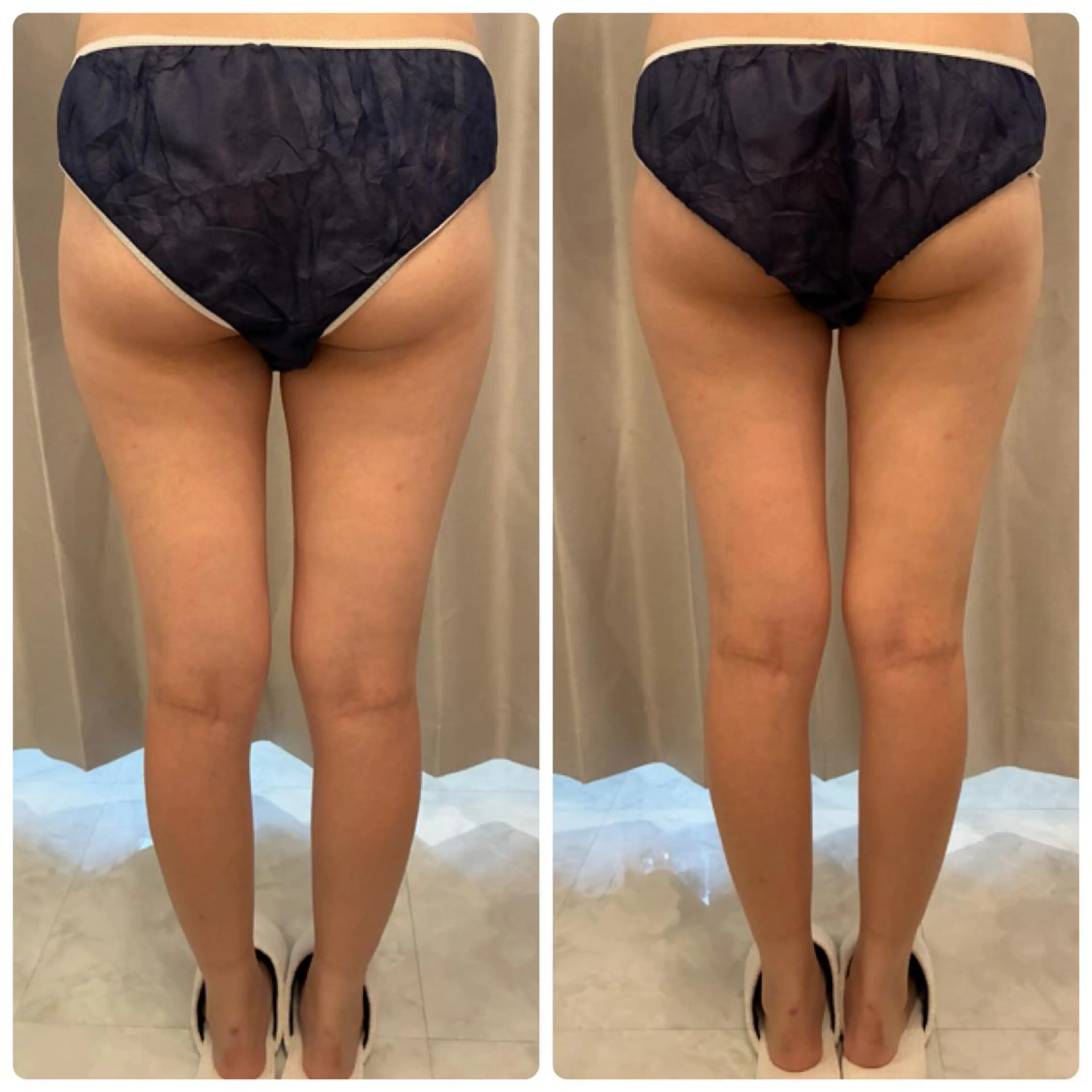 エステ リラク FLEURフェイシャ ル🫧ハーブ🌿小顔のエステ・リラクイメージ