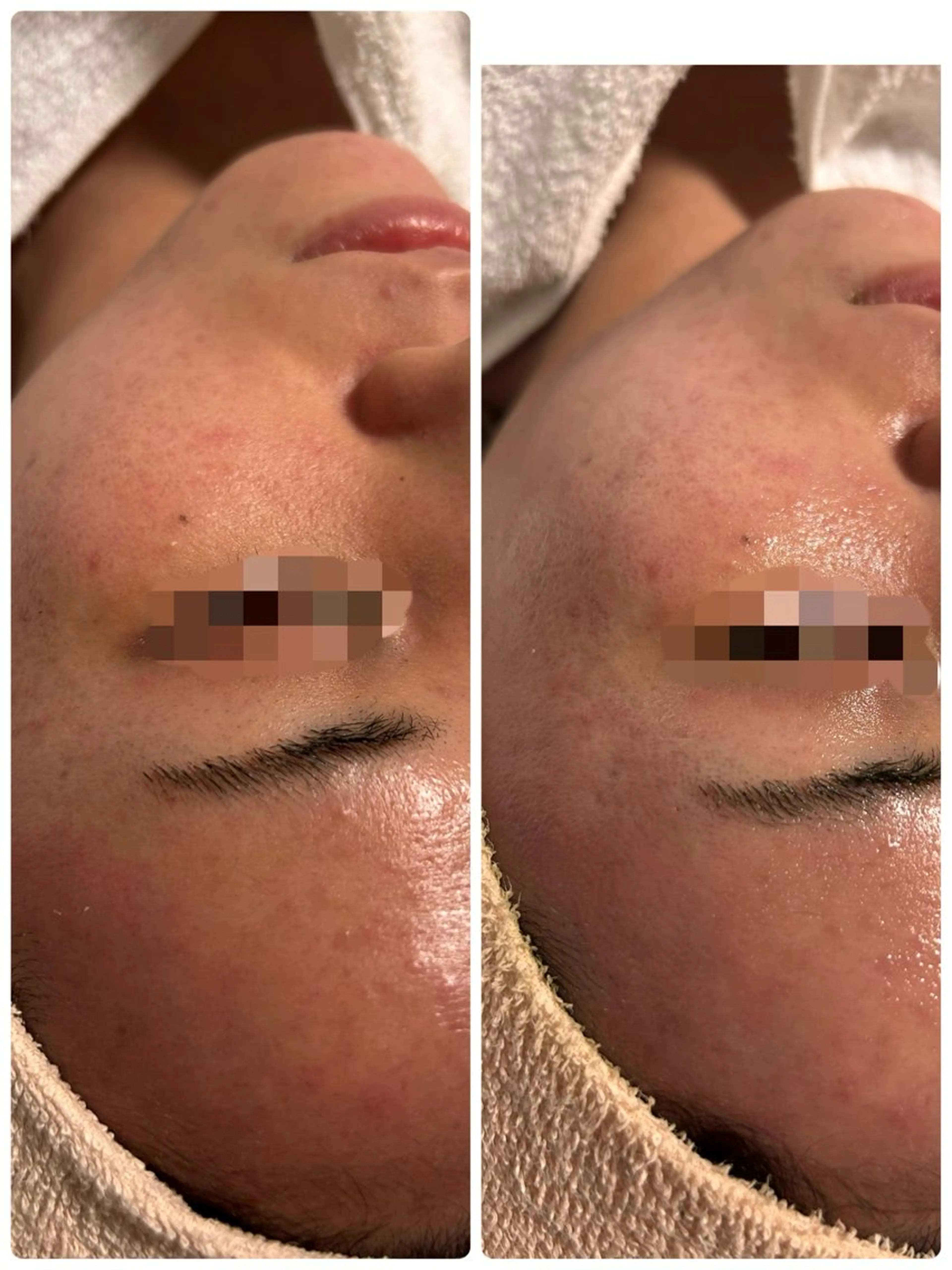 エステ リラク lumirise所属・lumi riseのエステ・リラクイメージ