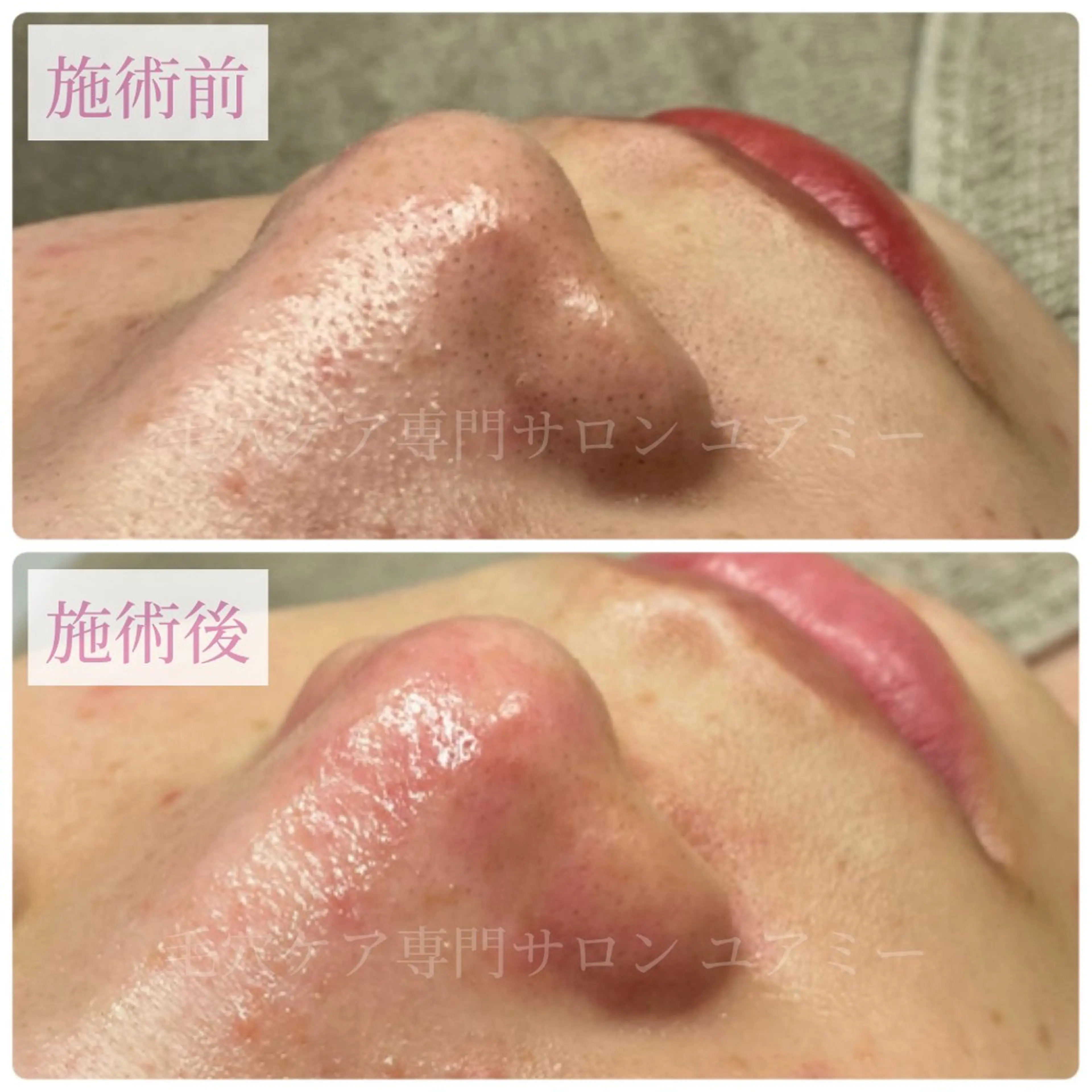 エステ リラク 毛穴肌質ケアサロン Yourmeユアミーのエステ・リラクイメージ