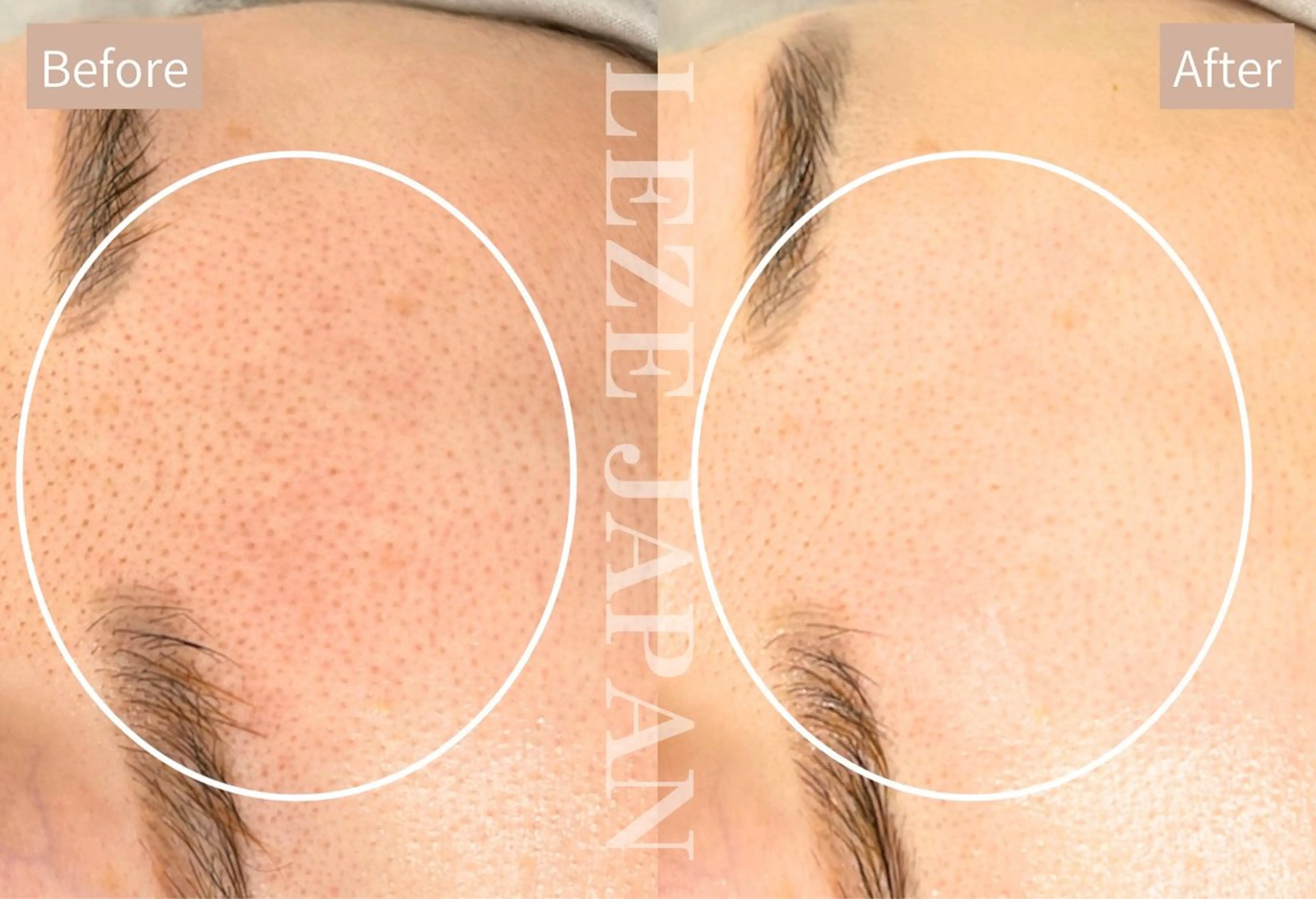 Lilyboo 池袋のエステ・リラクイメージ