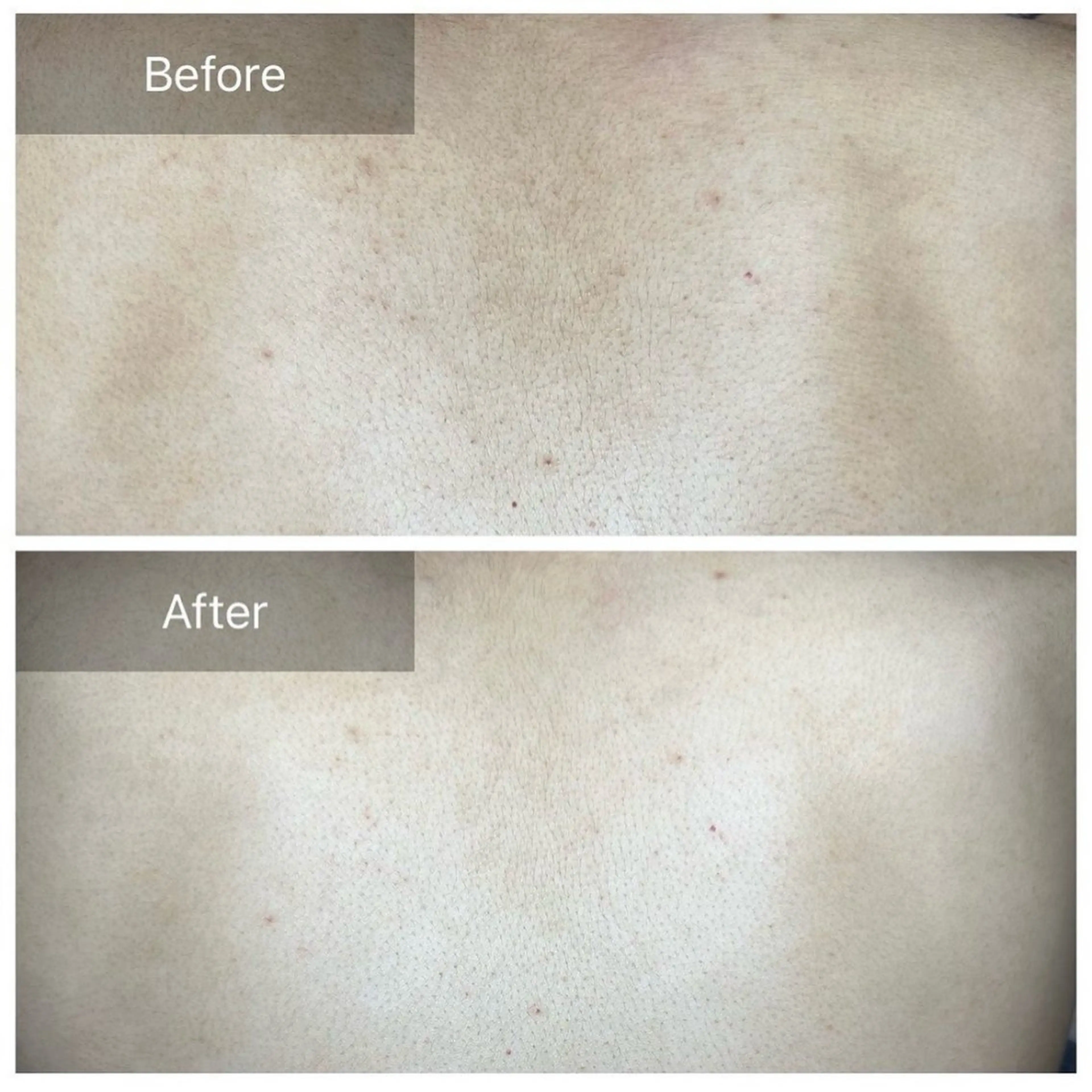 デ･アイム あま所属・かすみ🌹あま/ エステのエステ・リラクイメージ