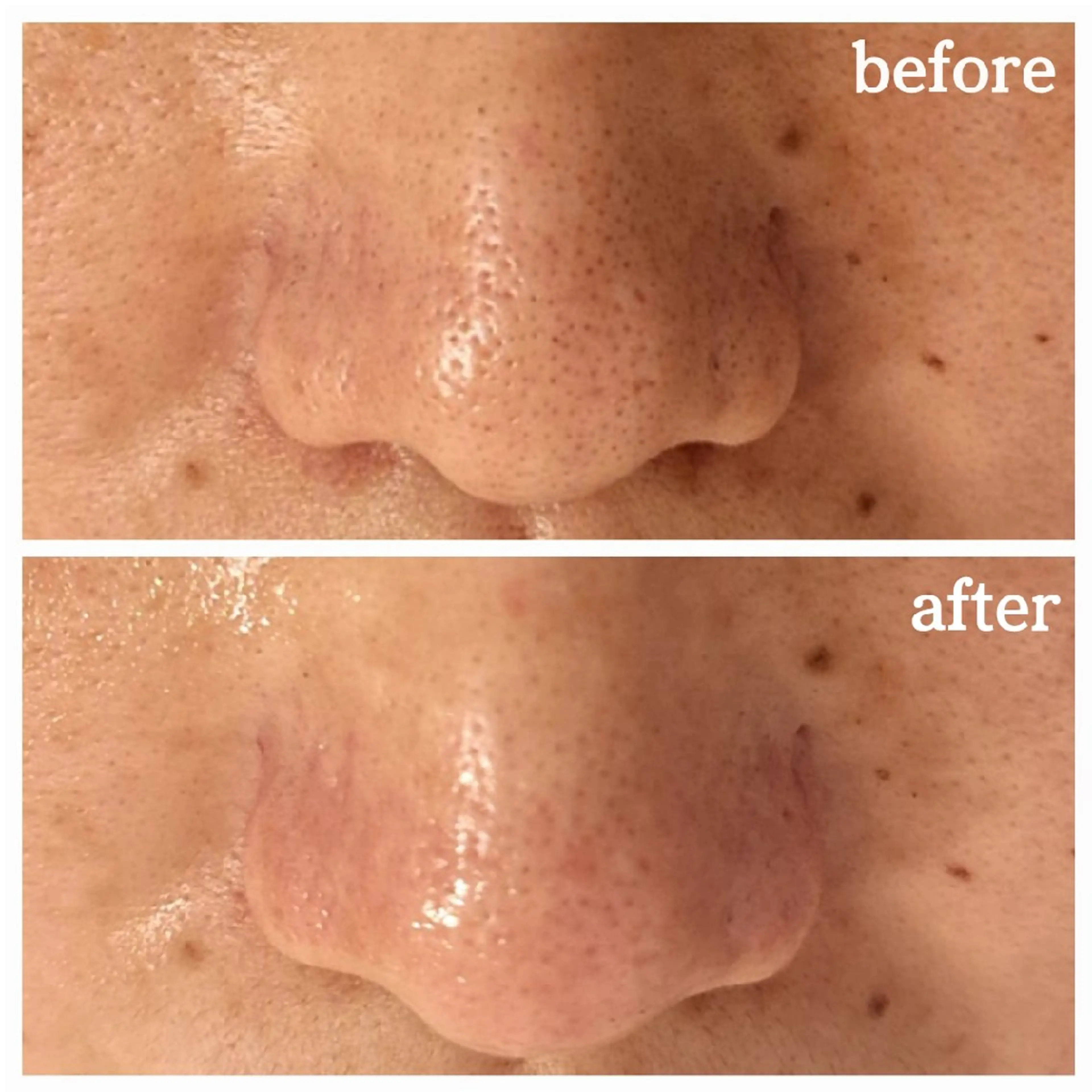 エステ フェイシャル専門サロ ン　ERINのエステ・リラクイメージ