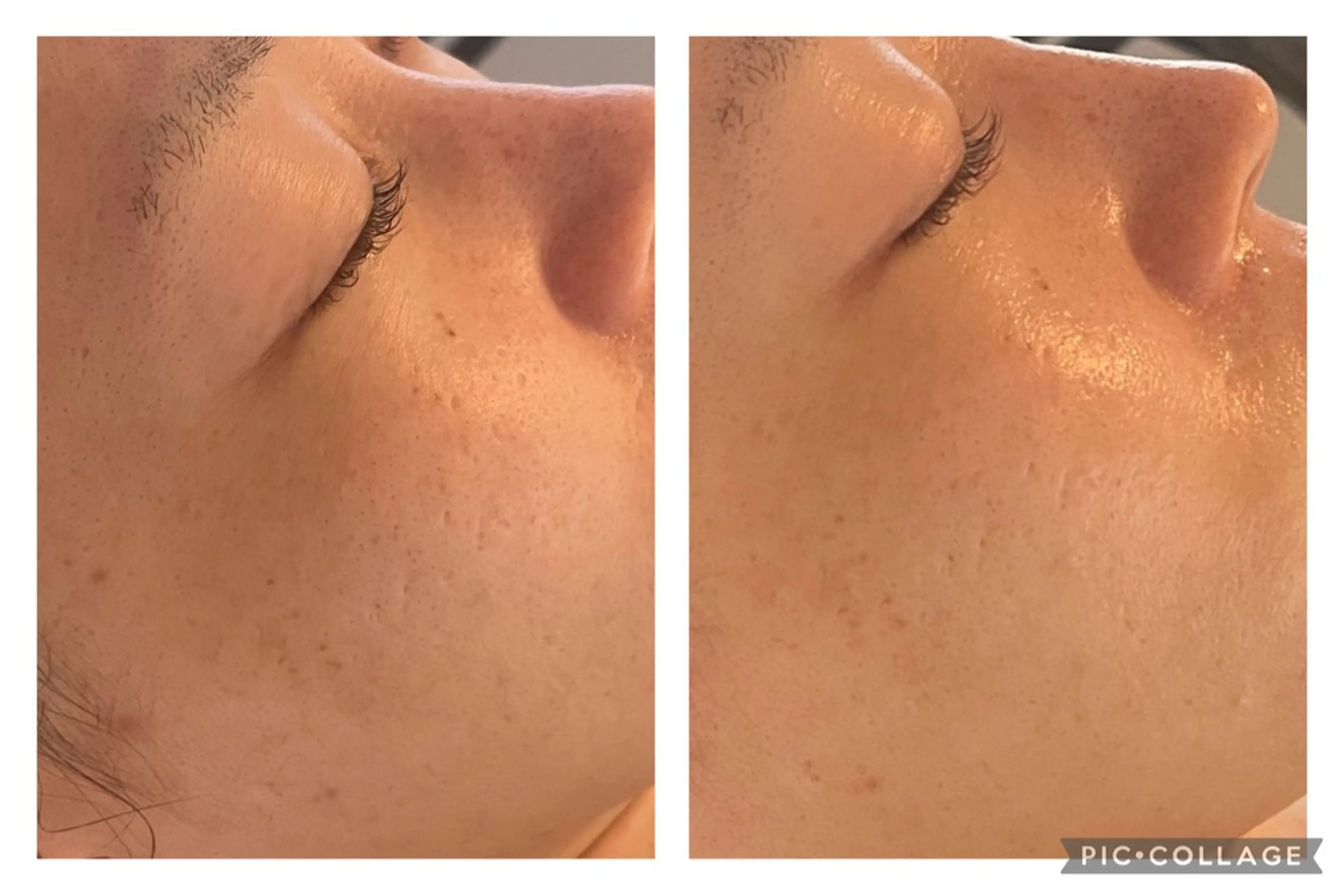 エステ 美肌サロン　ナゴミプラス所属・美肌とヘッド　和み+ 福　千賀子のエステ・リラクイメージ