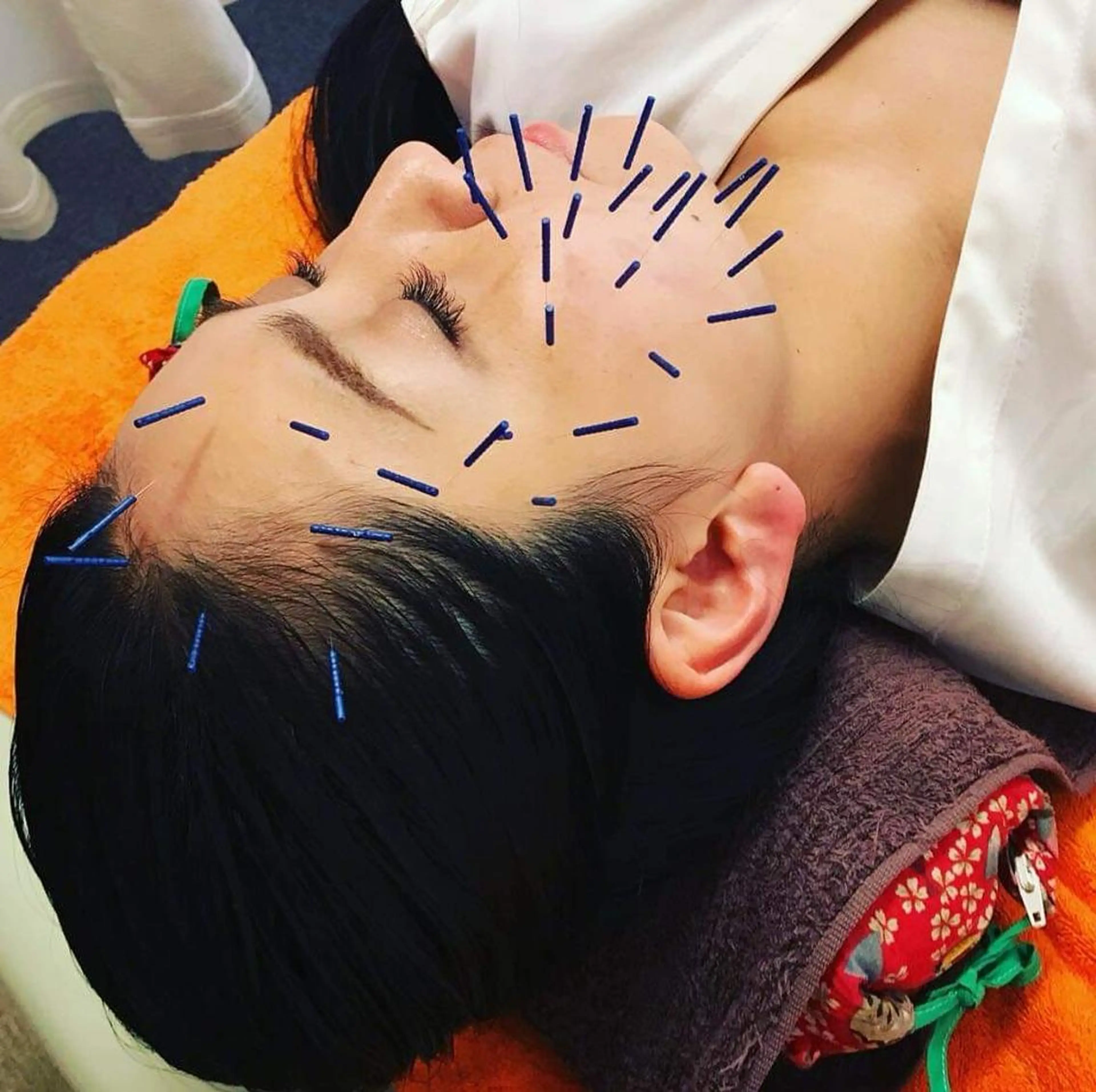 北梅田美容鍼灸院所属・美容鍼マイスター 川村　淳のエステ・リラクイメージ