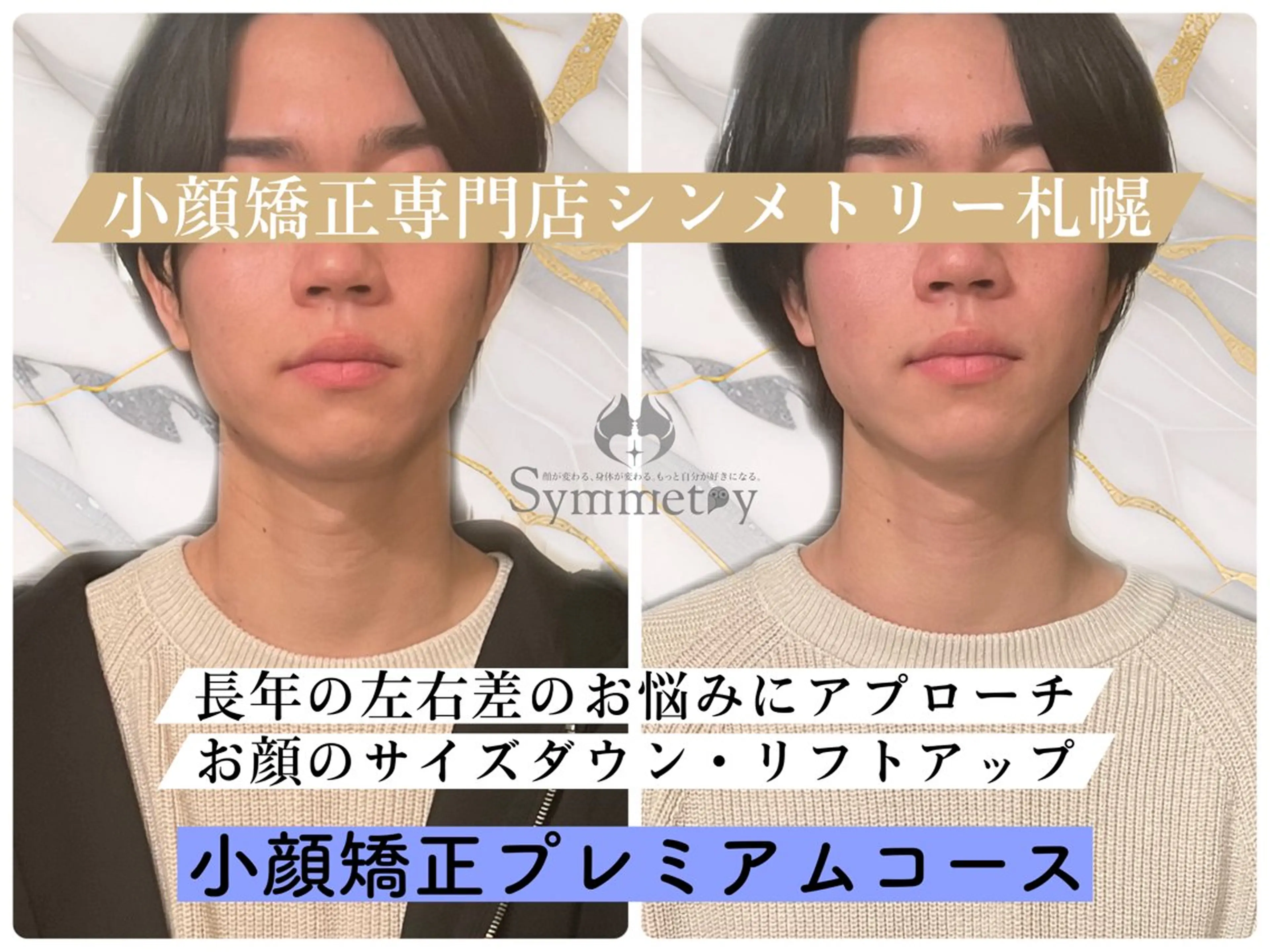 《お顔の左右差・歪みを解消!》メンズ小顔矯正スタンダードコース60分の写真