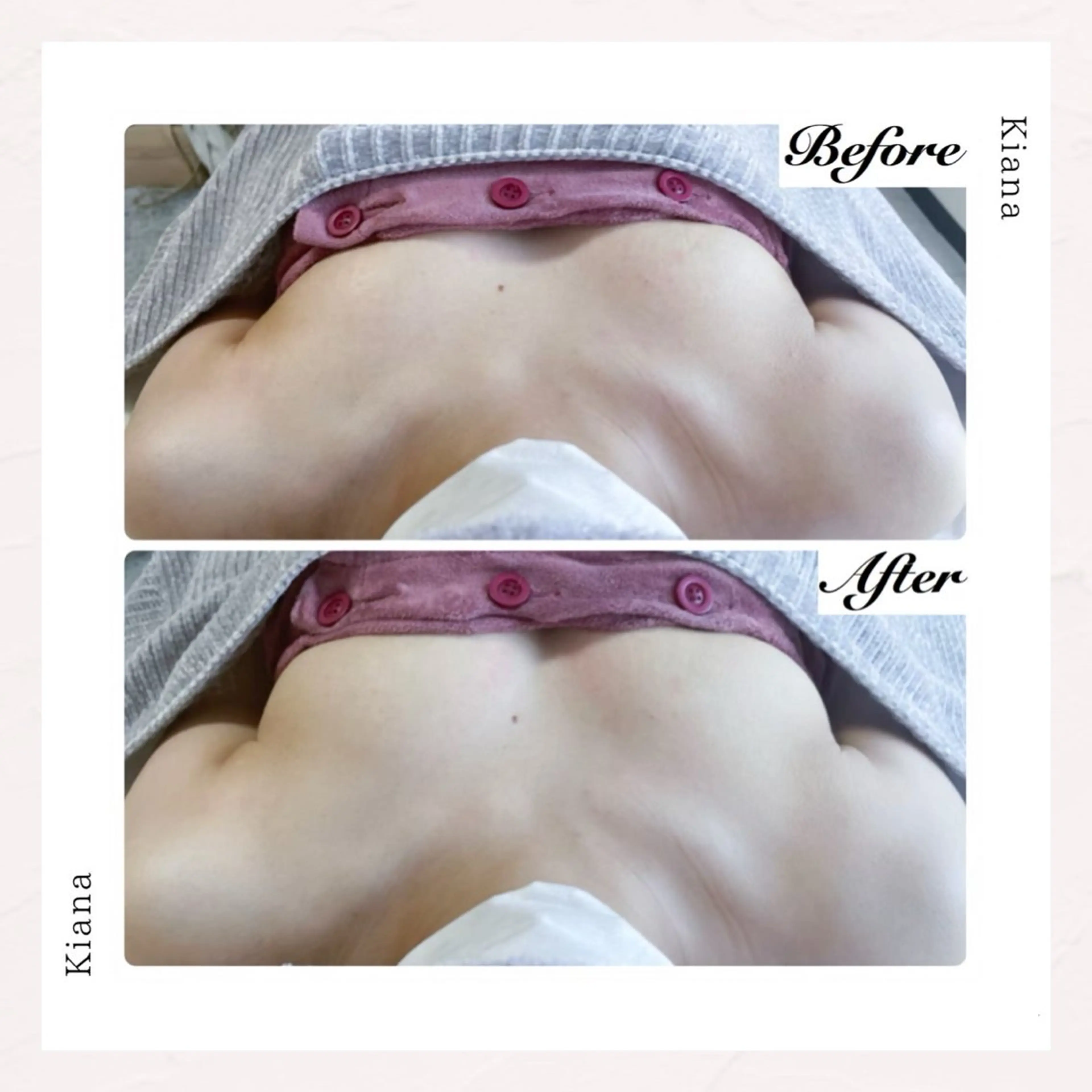 バスト専門Kiana 風のエステ・リラクイメージ