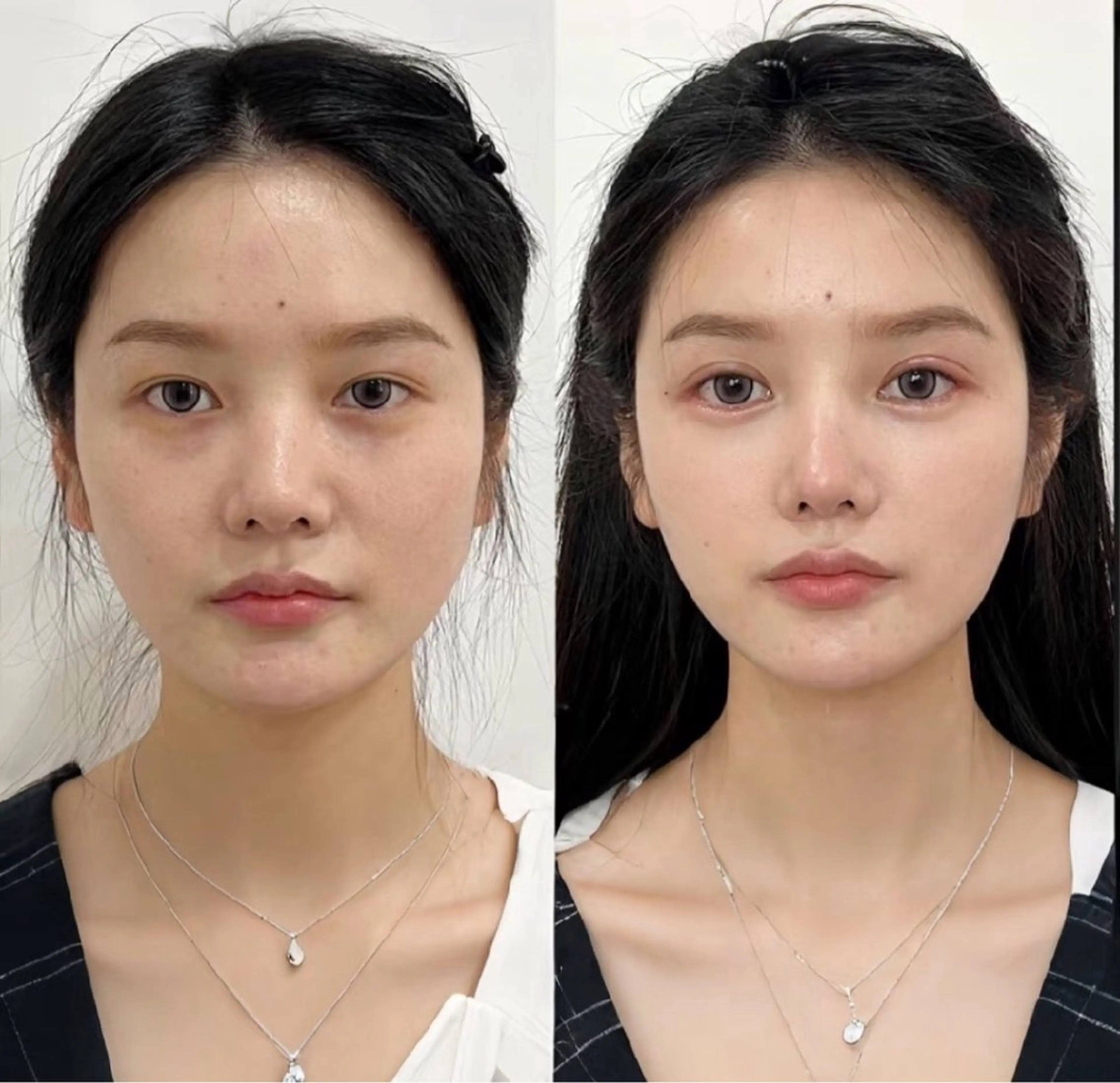 マツエク・マツパ エステ リラク 愛維美水光美肌専門店所属・愛維美水光美肌専門店 メンズレディースokのエステ・リラクイメージ