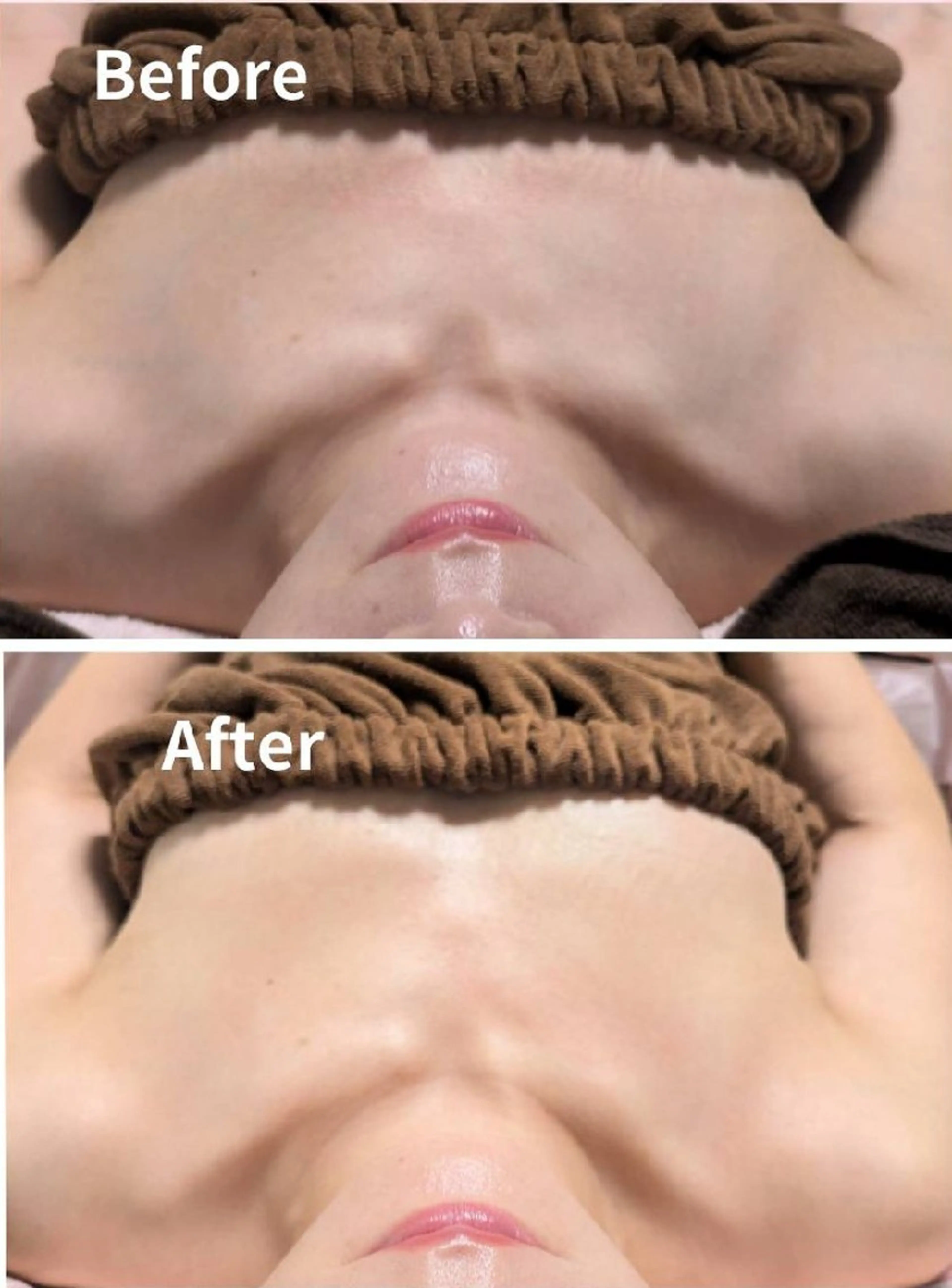 Myua ミュア所属・Myua ミュアのエステ・リラクイメージ