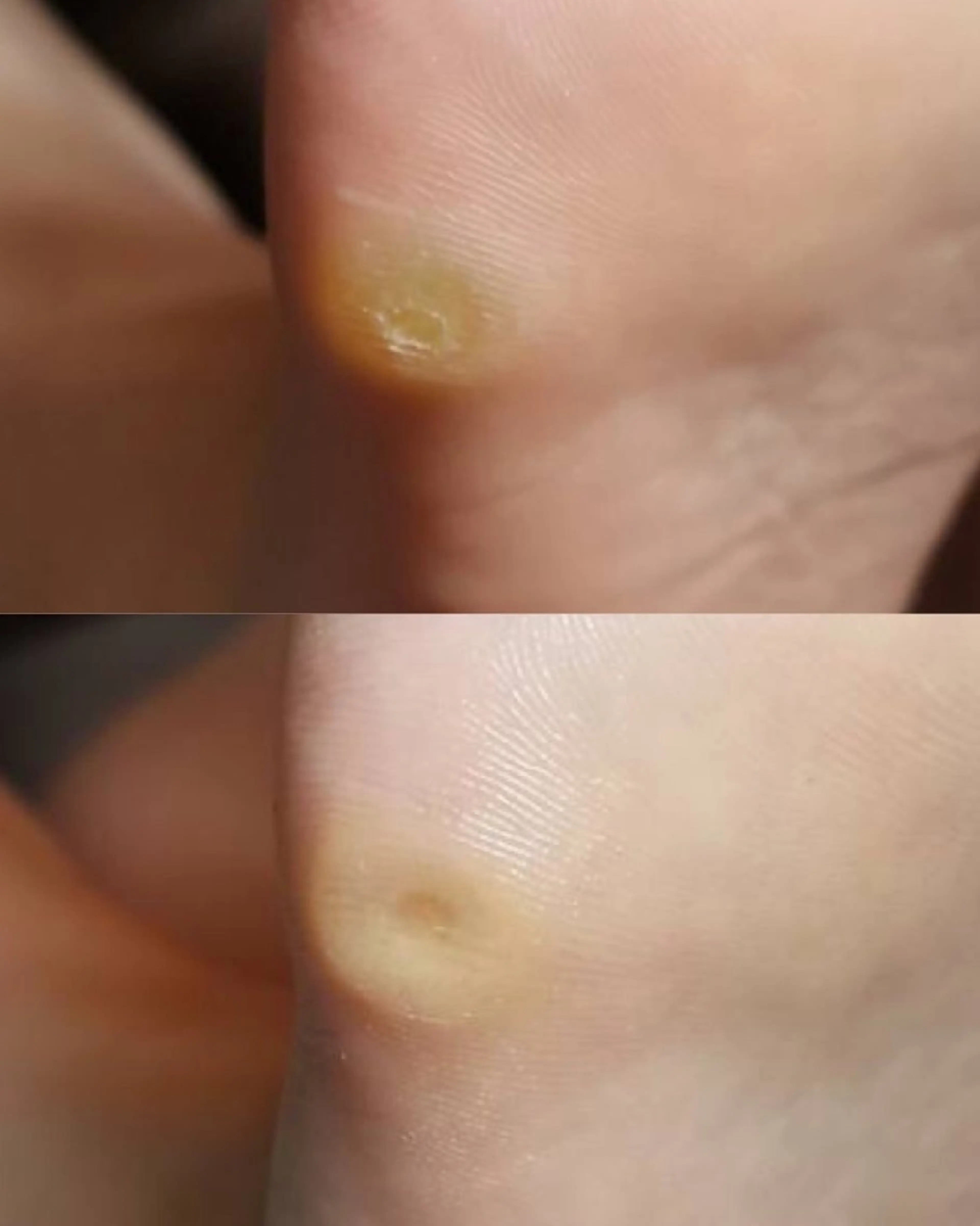 ネイル ROUN' 齋藤のエステ・リラクイメージ