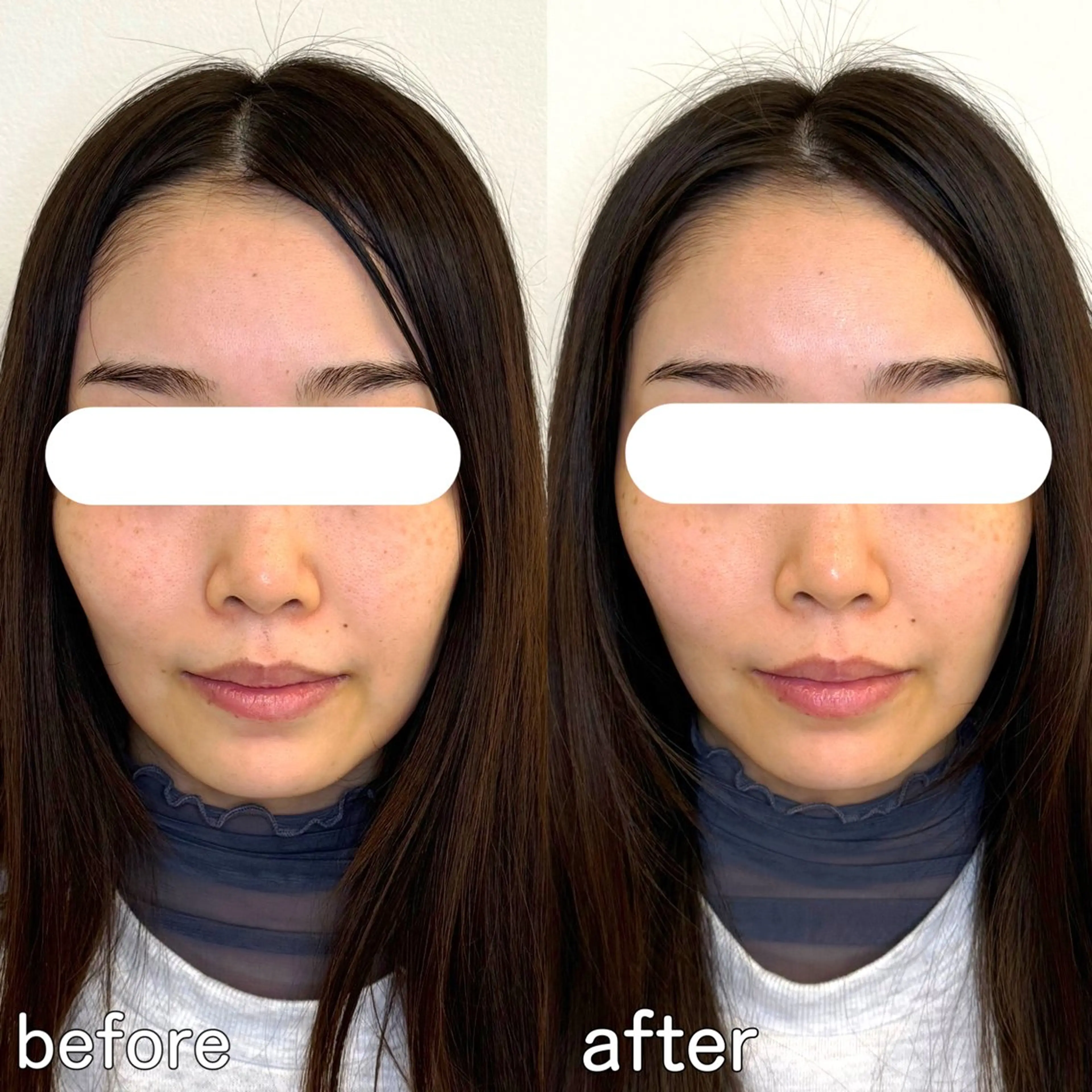 小顔矯正&美容整体 整え屋REDオーナーのエステ・リラクイメージ