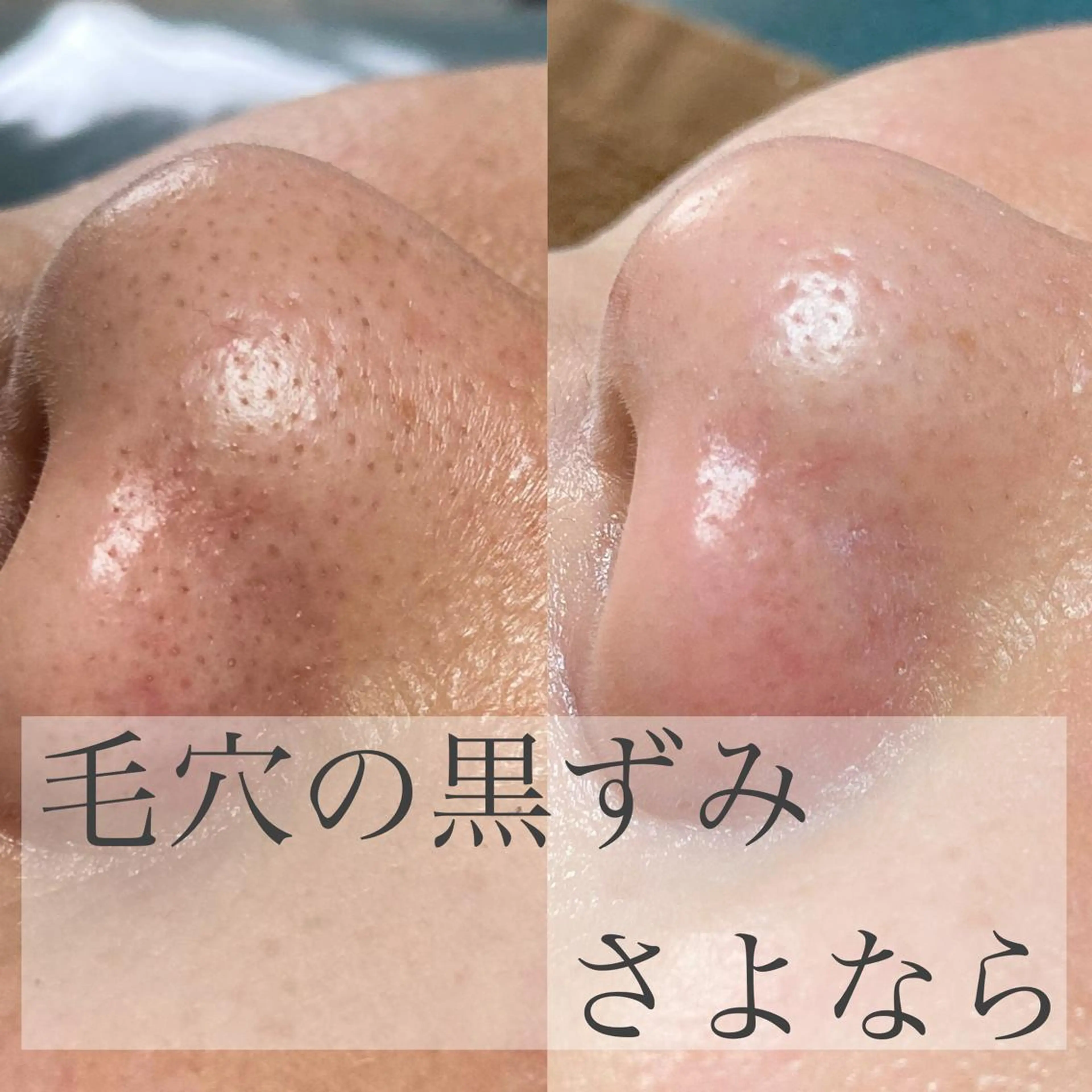 eyelashsalon Plaisir所属・ツカハラ ミカのエステ・リラクイメージ