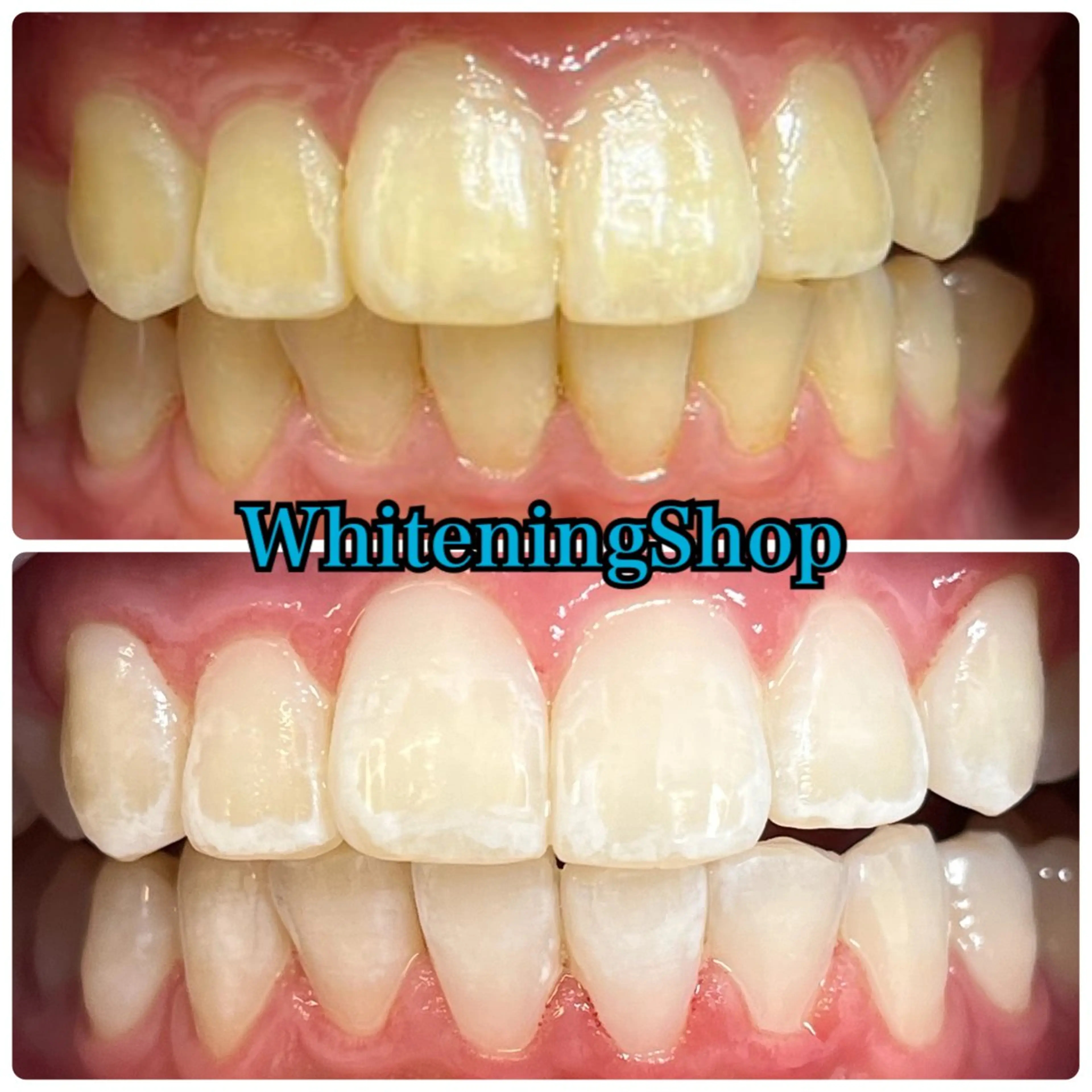 エステ リラク ホワイトニング ショップ吉祥寺店のエステ・リラクイメージ