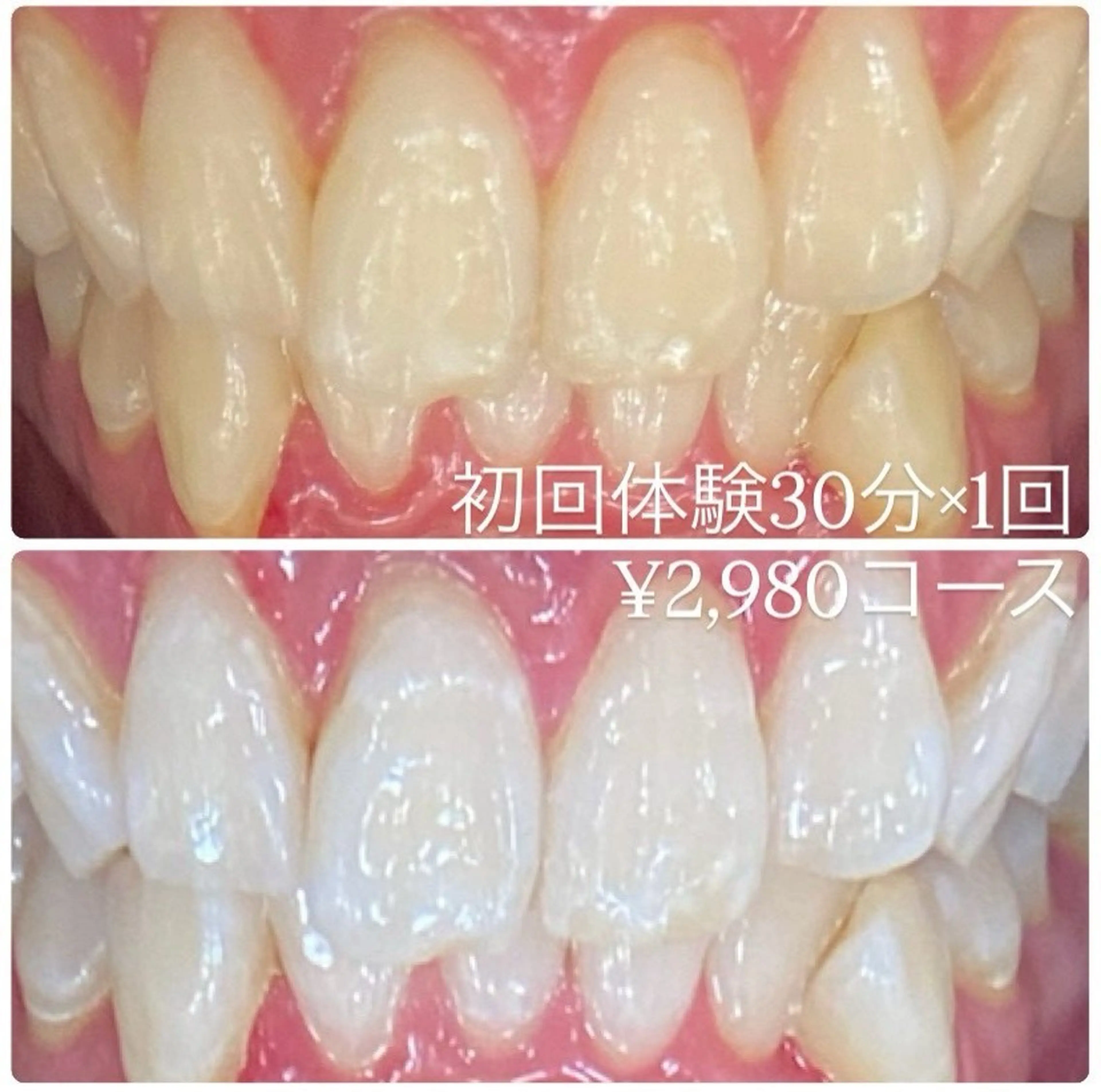 メンズ その他 ホワイトニングルーム 川崎店所属・ホワイトニング ルーム 川崎店のその他イメージ