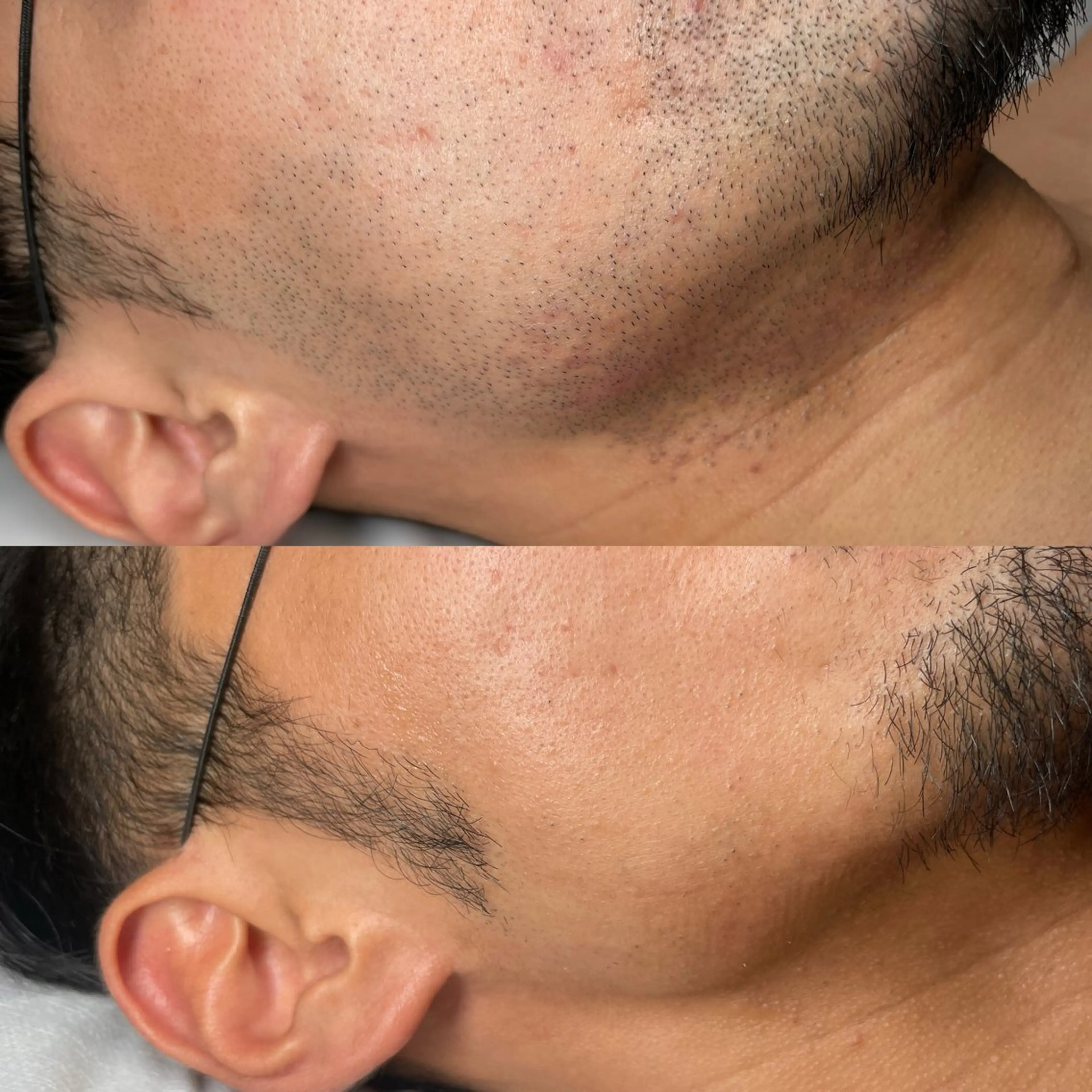 メンズ mimi 広島 安佐南区まつ毛･脱毛のマツエク・マツパデザイン