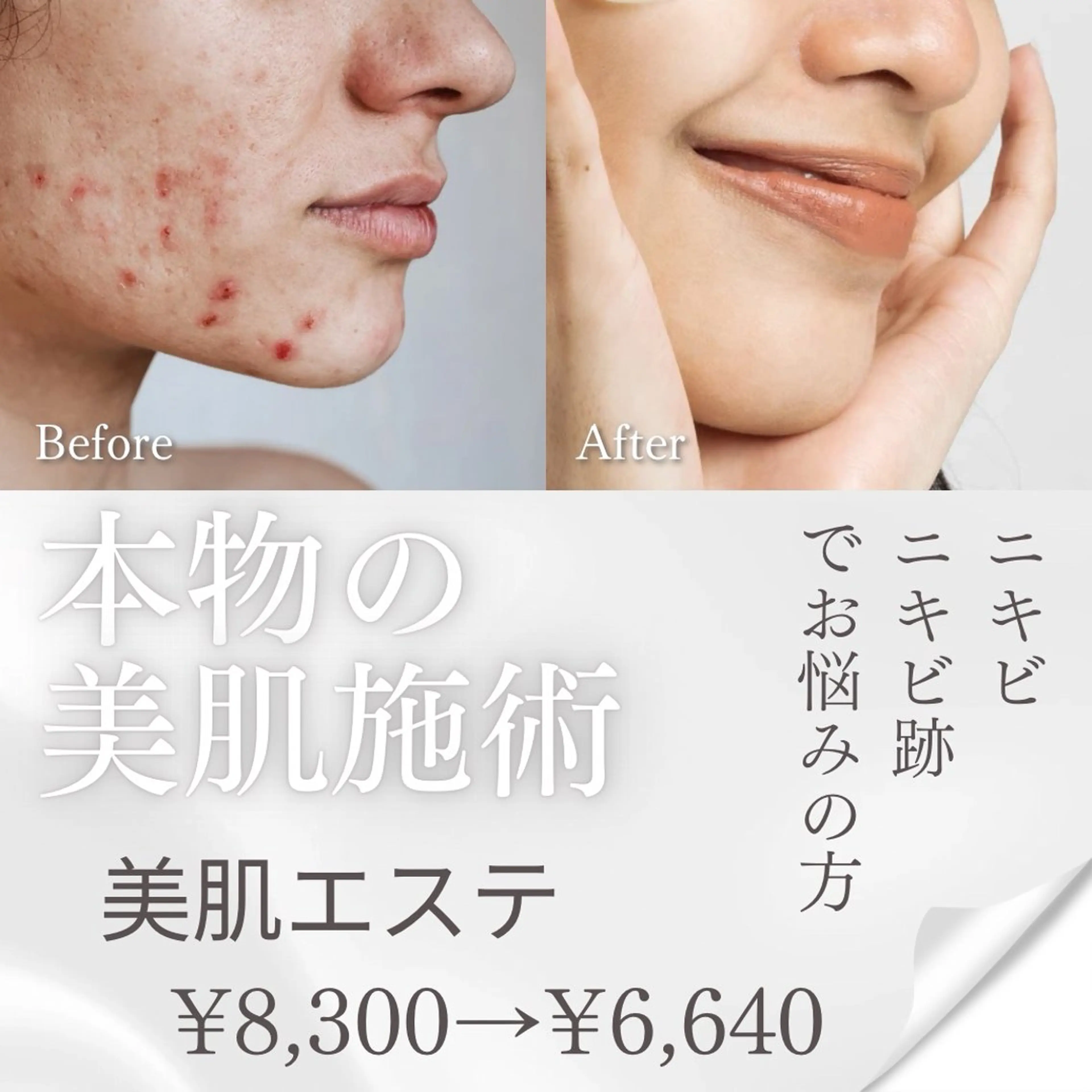 メンズ キッズ 韓国最先端技術サロン Luangeのエステ・リラクイメージ