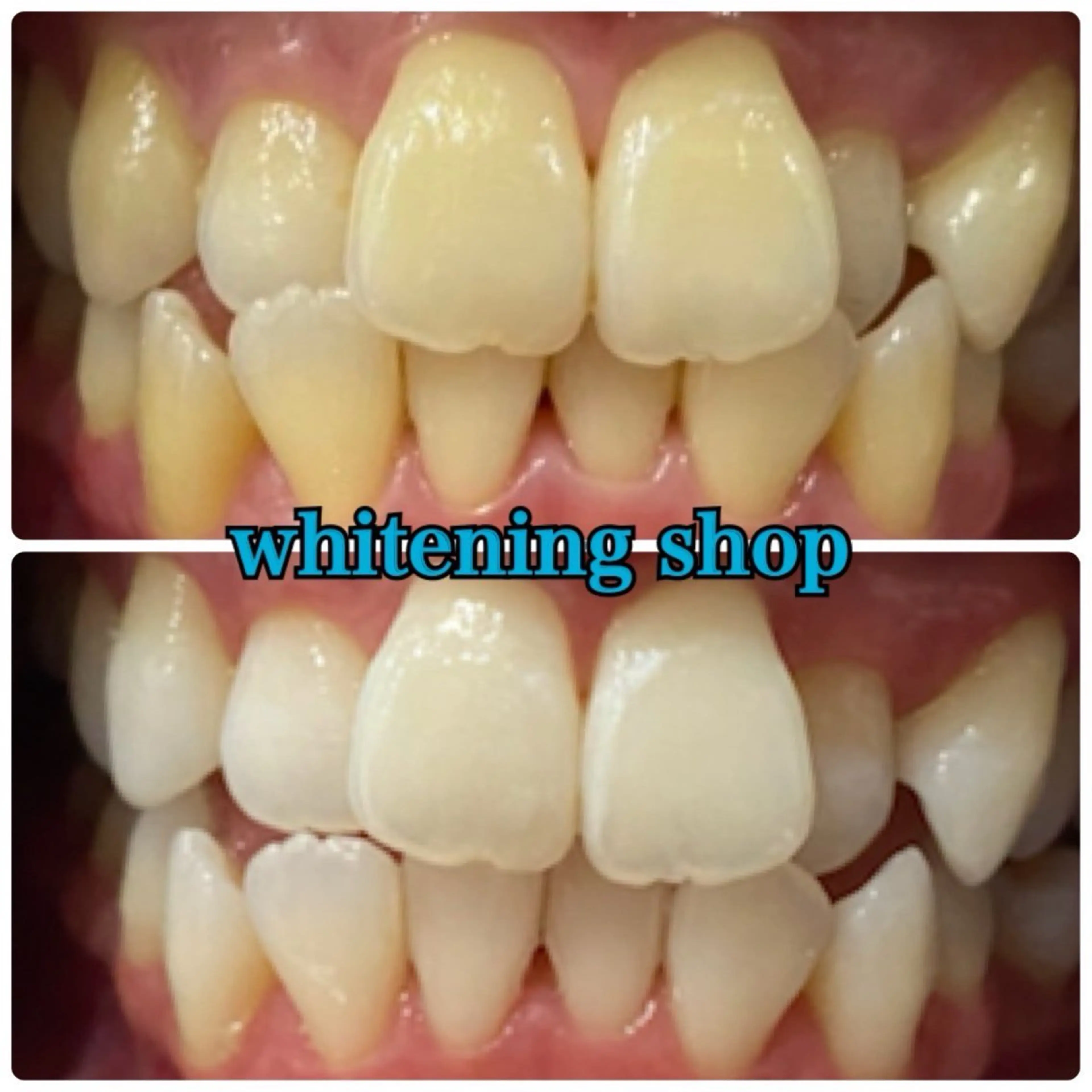 メンズ エステ リラク ホワイトニング ショップ川越店のエステ・リラクイメージ