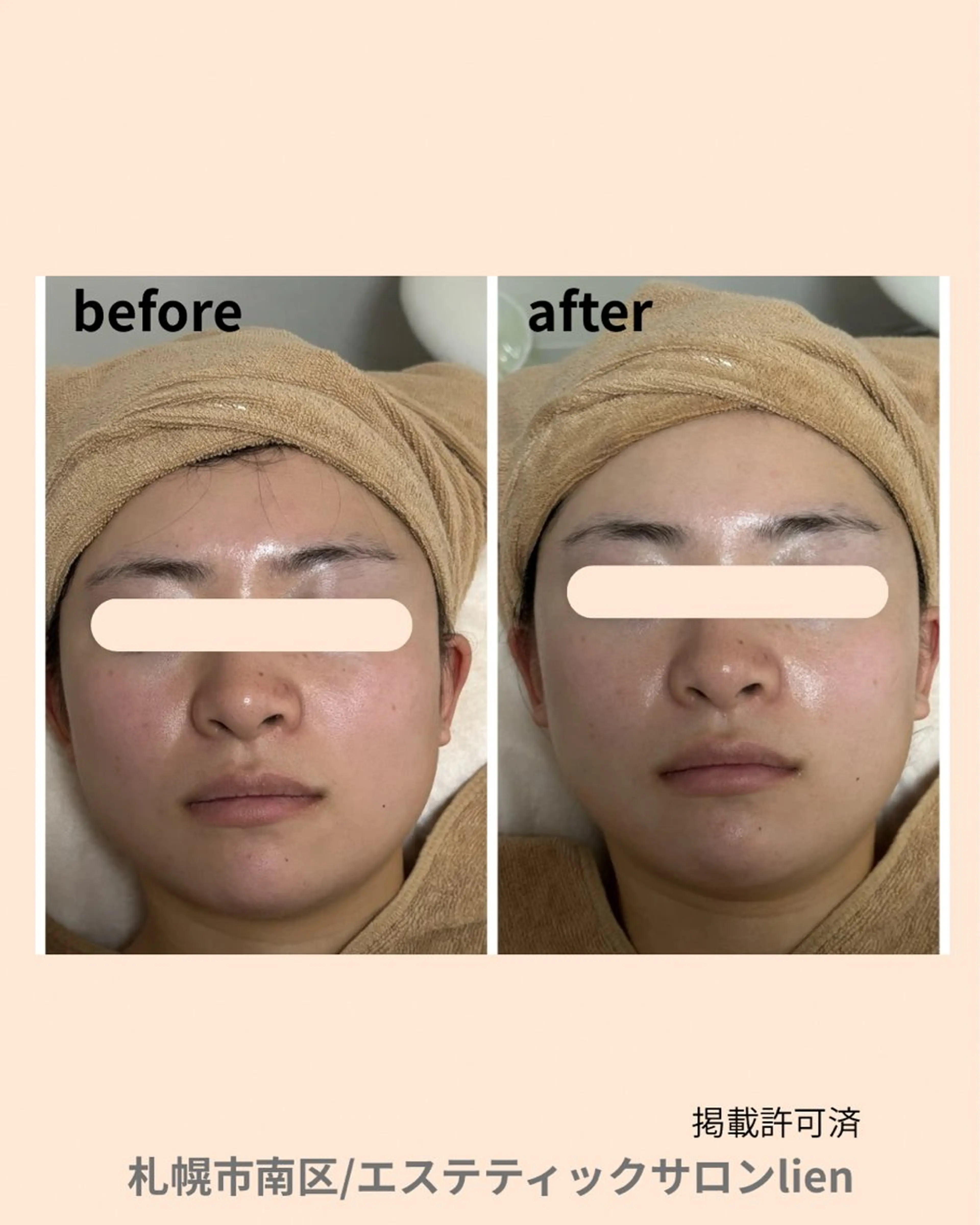 エステティックサロン　リアン所属・hiro_ narisのエステ・リラクイメージ