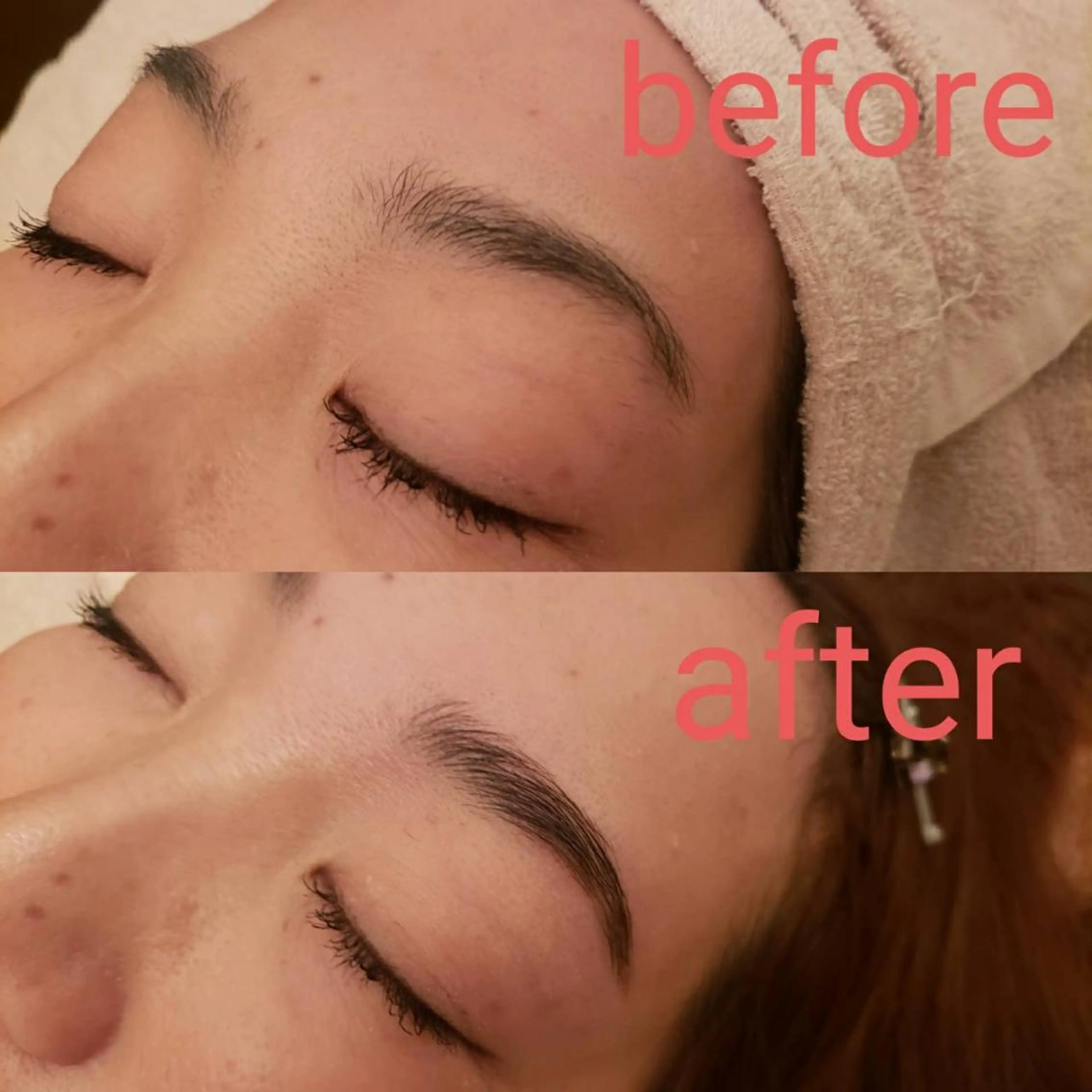 脱毛 鈴木 愛花のエステ・リラクイメージ