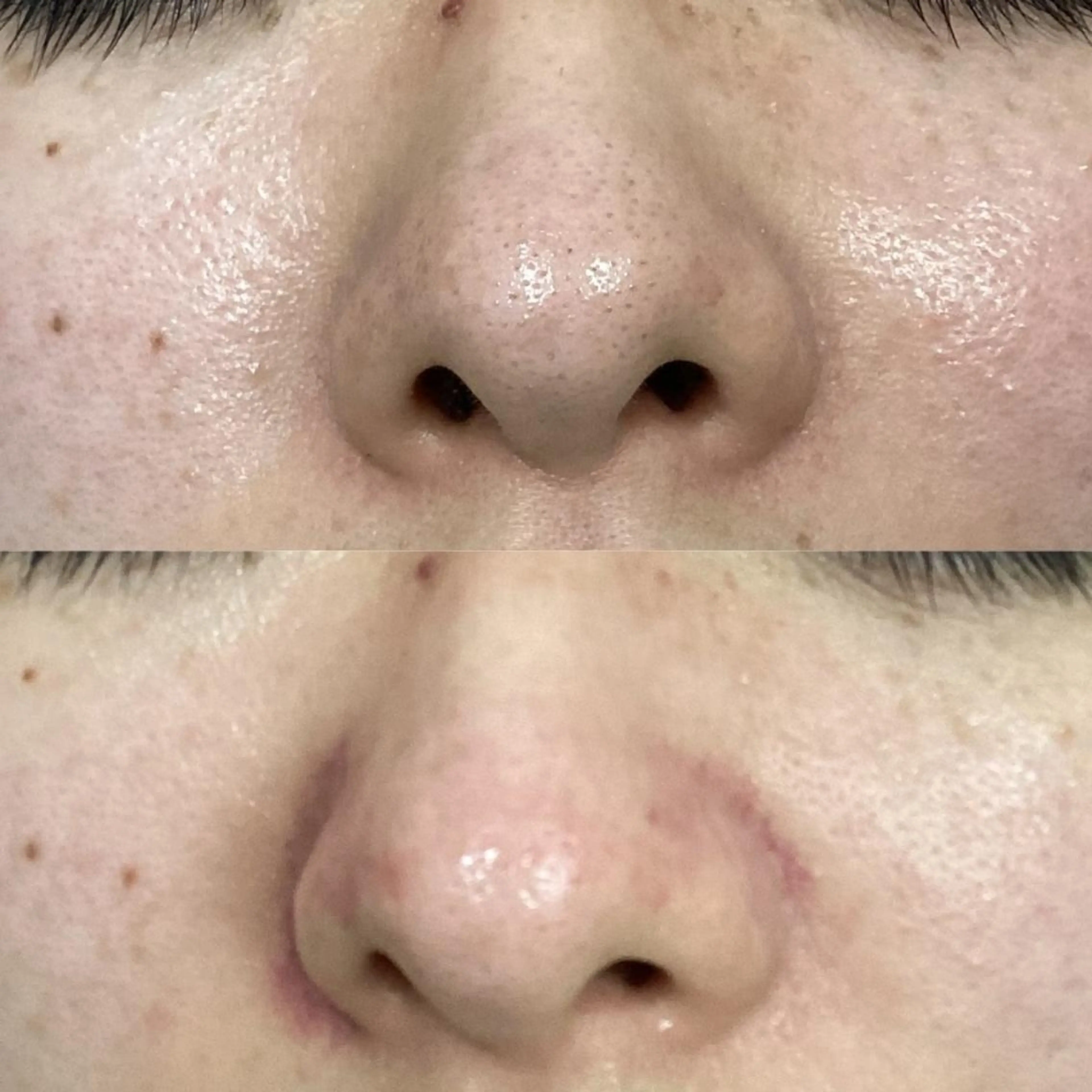 エステ 美肌専門サロン RUBONのエステ・リラクイメージ