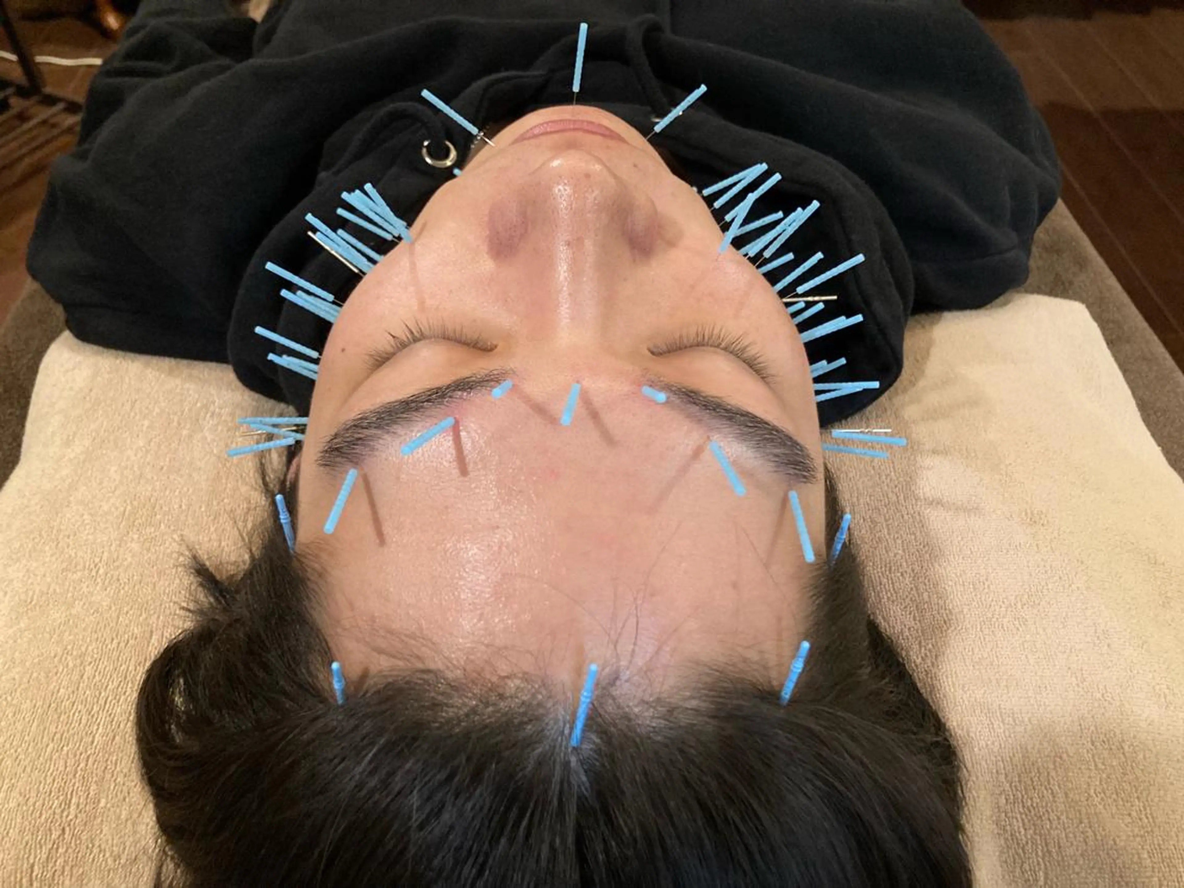 その他 美容鍼サロンAcutyアキュティ吉祥寺所属・橋爪 弘樹のその他イメージ