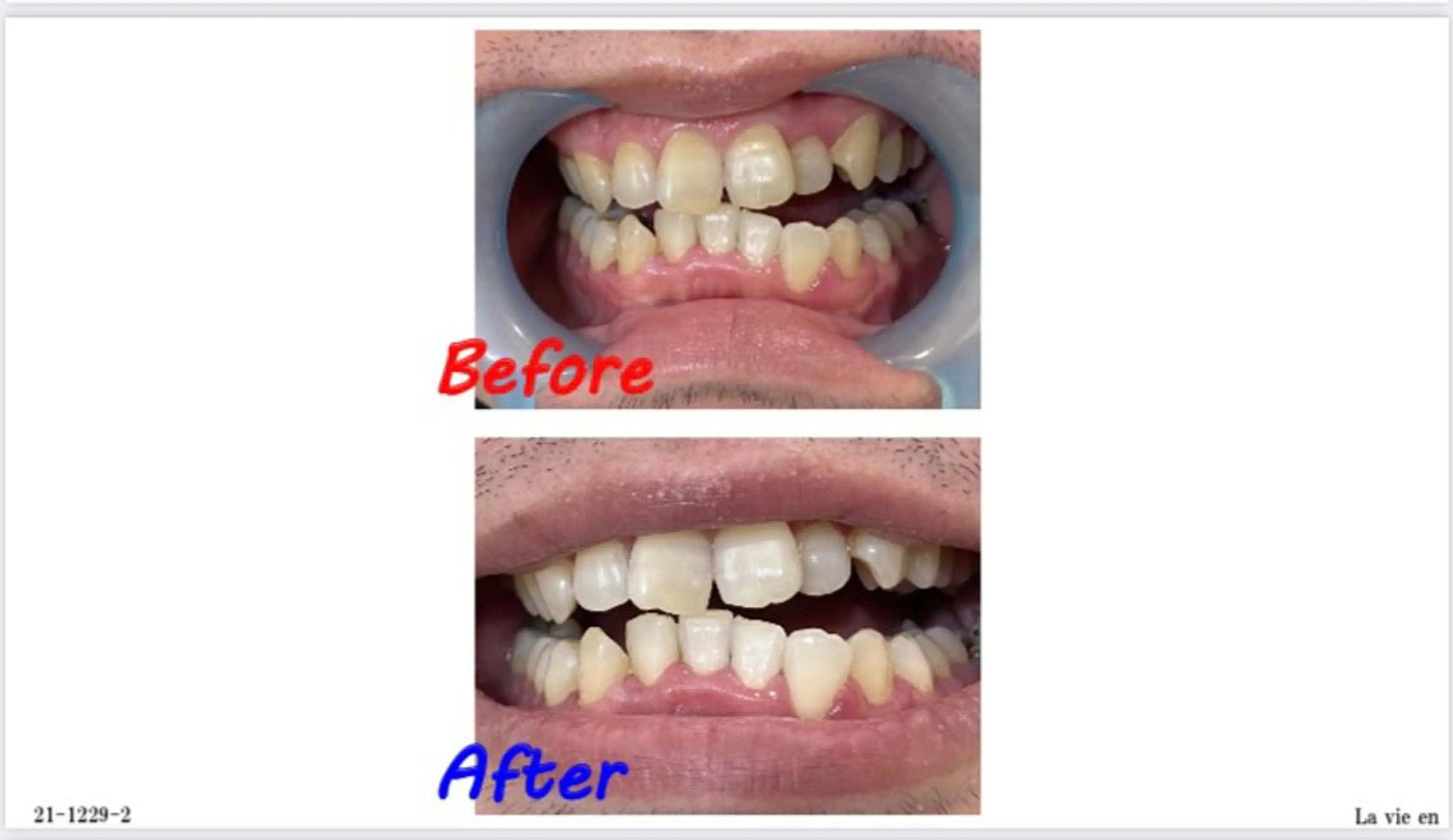 その他 セルフホワイトニングサロン　ラヴィアン所属・ホワイトニングサロン La vie enのその他イメージ