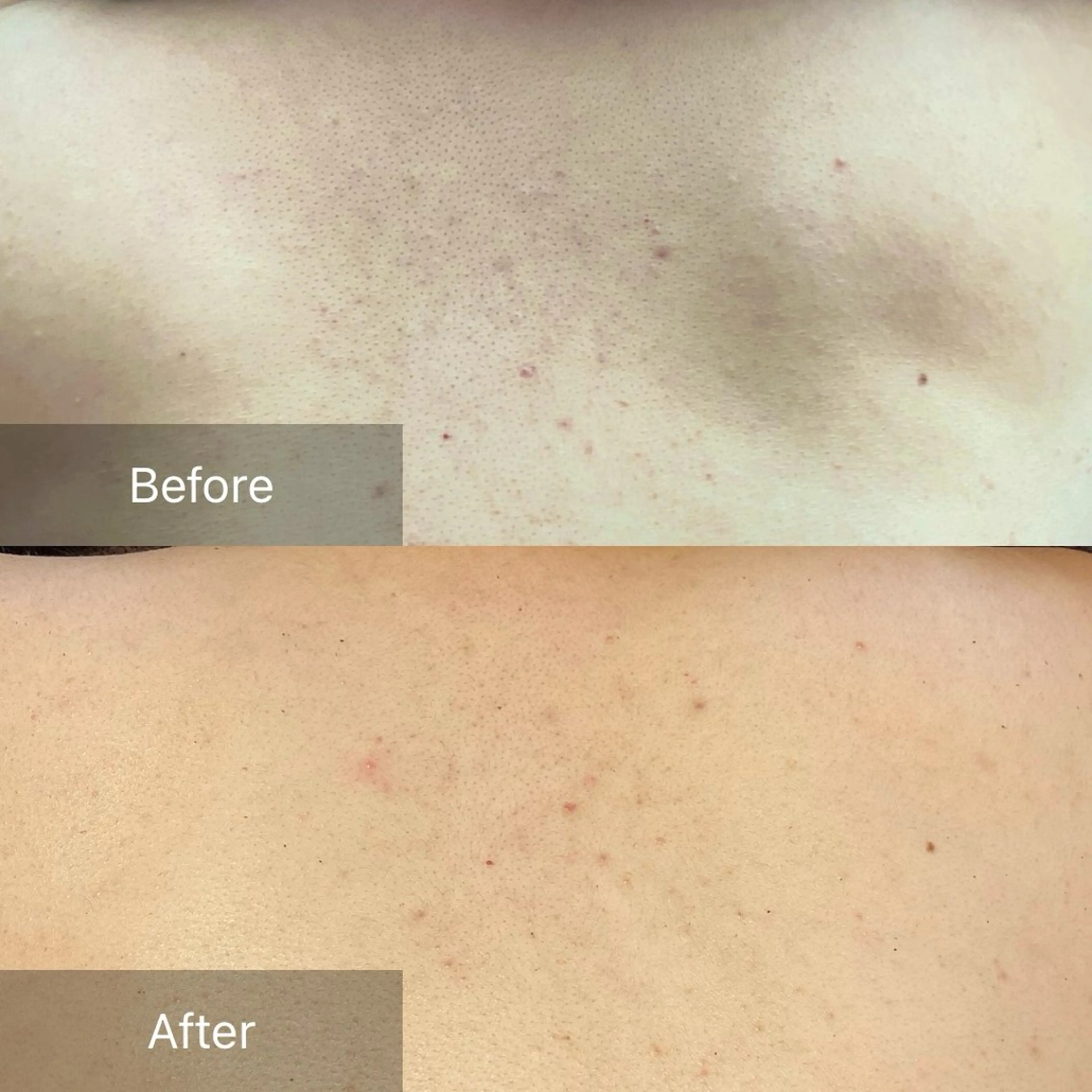 肌育ピーリング 🫧megumiのエステ・リラクイメージ