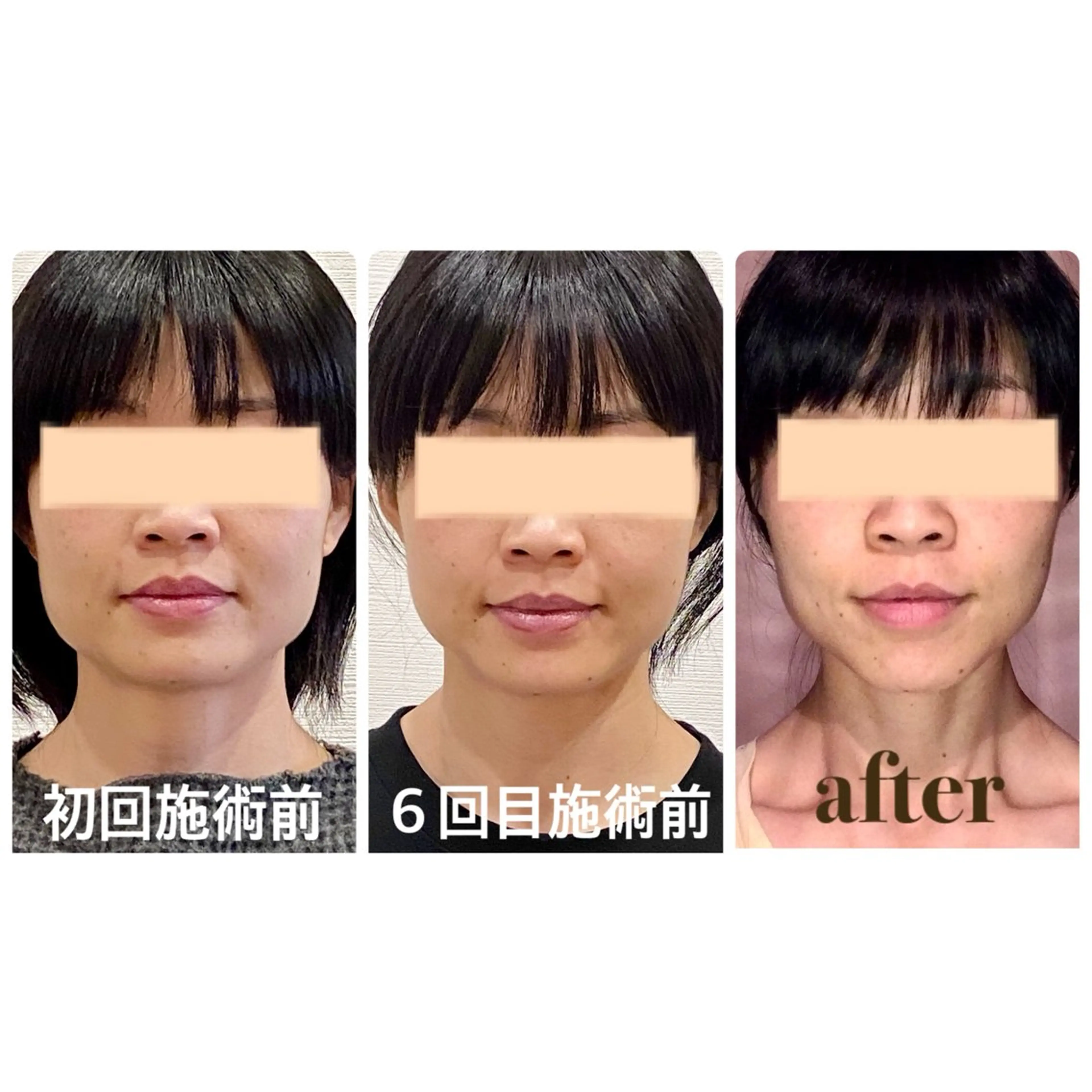 Cream 福井のエステ・リラクイメージ