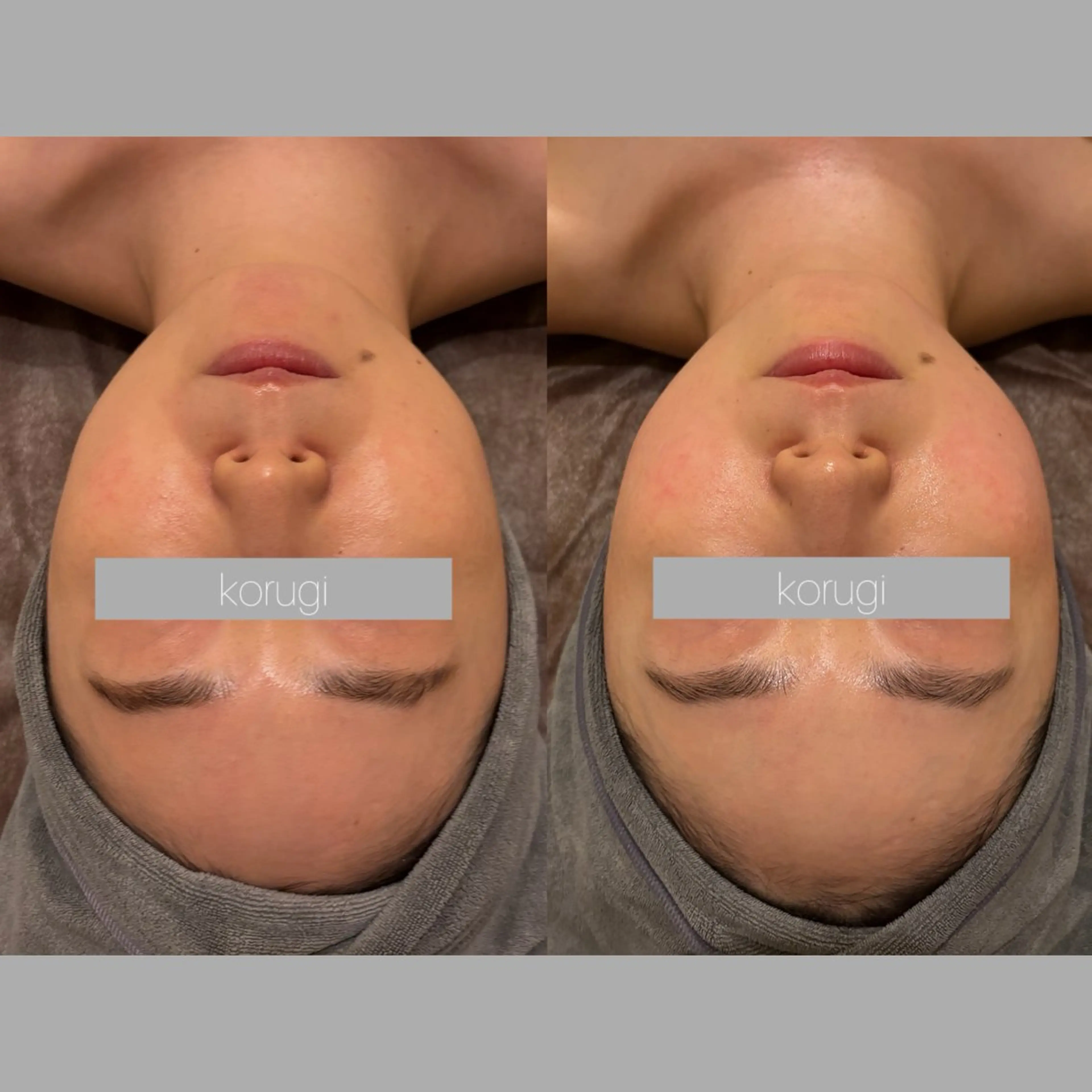 エステ ☆痩身/小顔☆ コルギのエステ・リラクイメージ