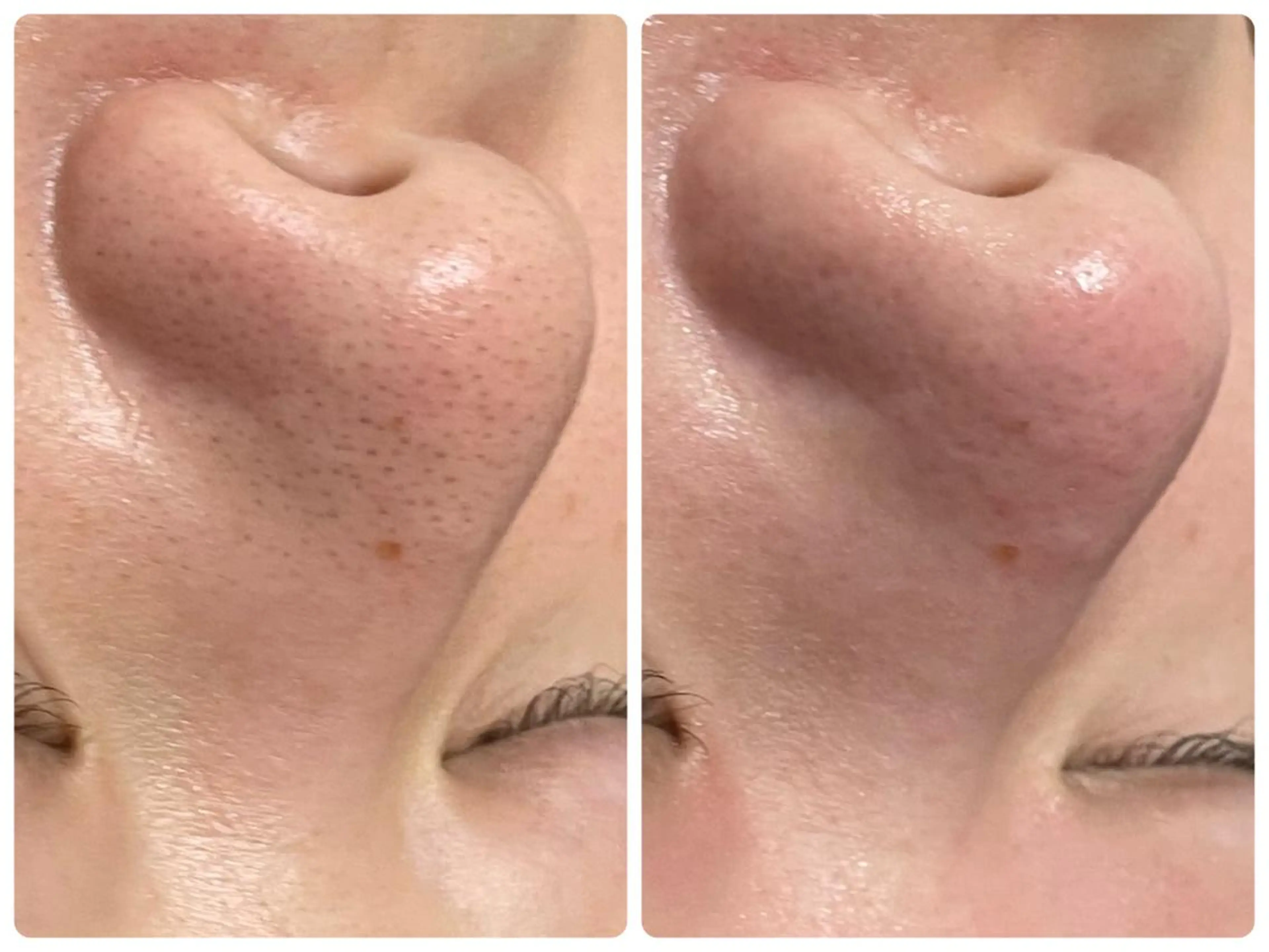 杉原 里奈のエステ・リラクイメージ