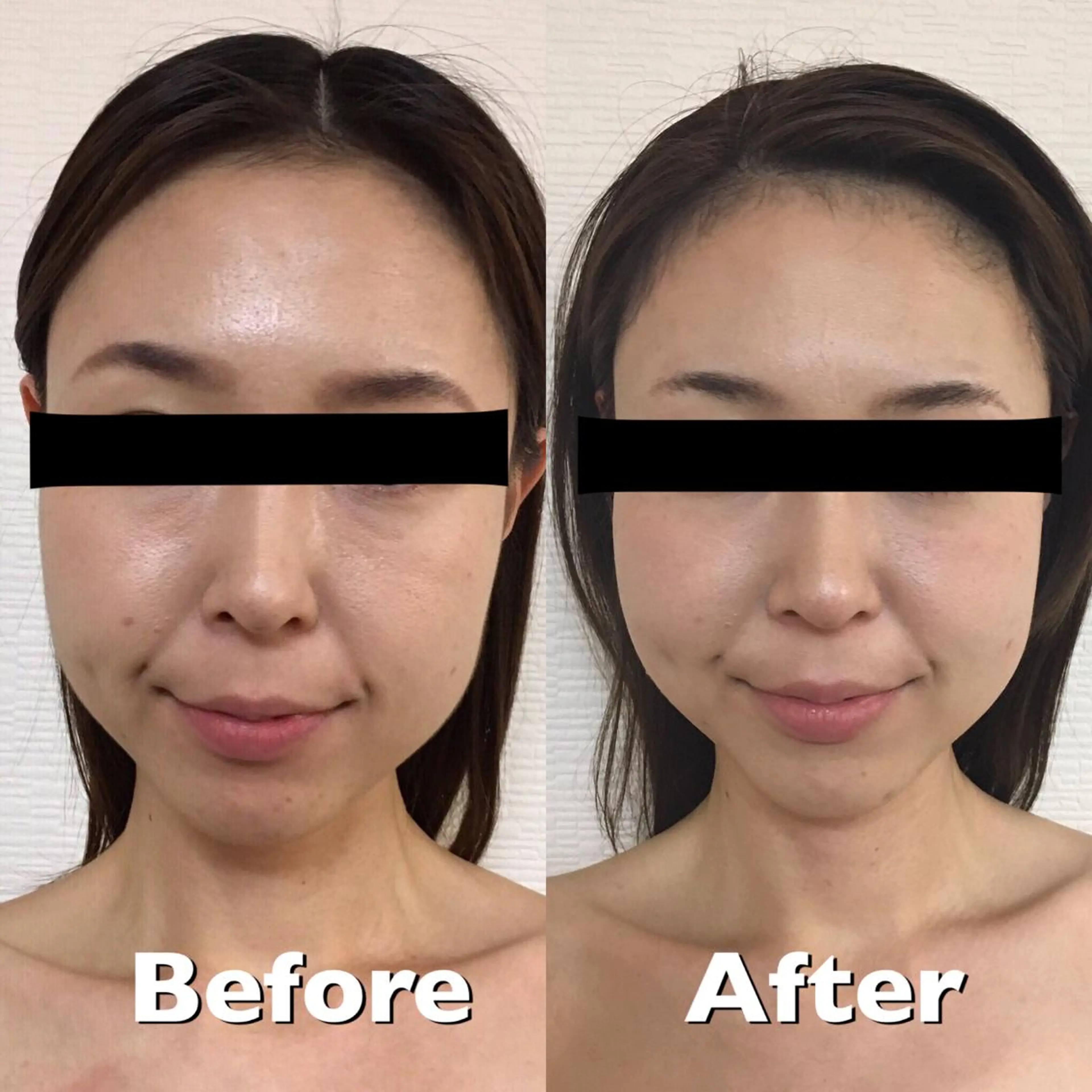 小顔筋膜矯正サロン桜Biscuit~サクラビスケット~所属・小顔/肩こり/脱毛 桜Bisucuitのエステ・リラクイメージ