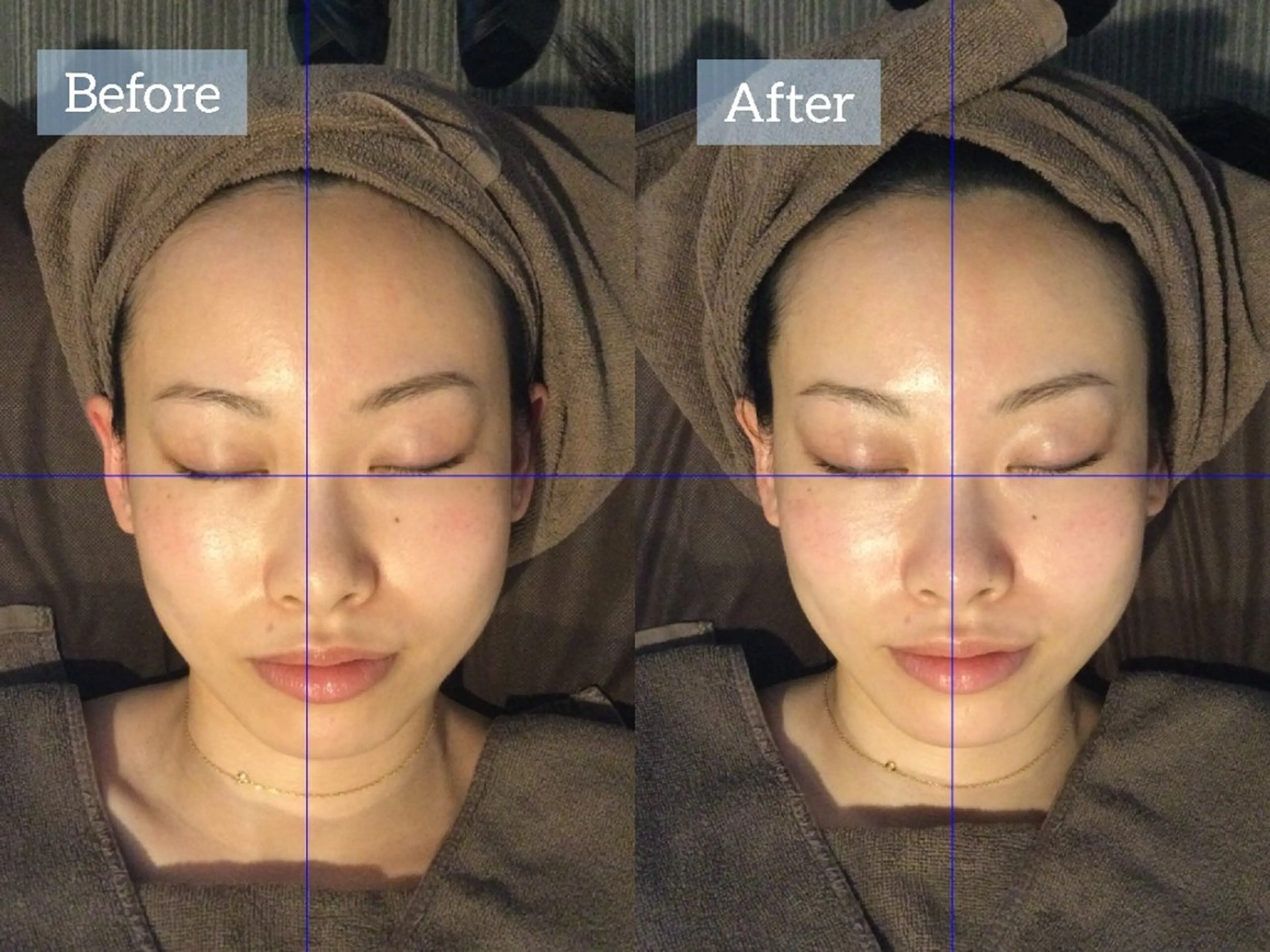 肌質改善専門店 Re.terna田辺のエステ・リラクイメージ