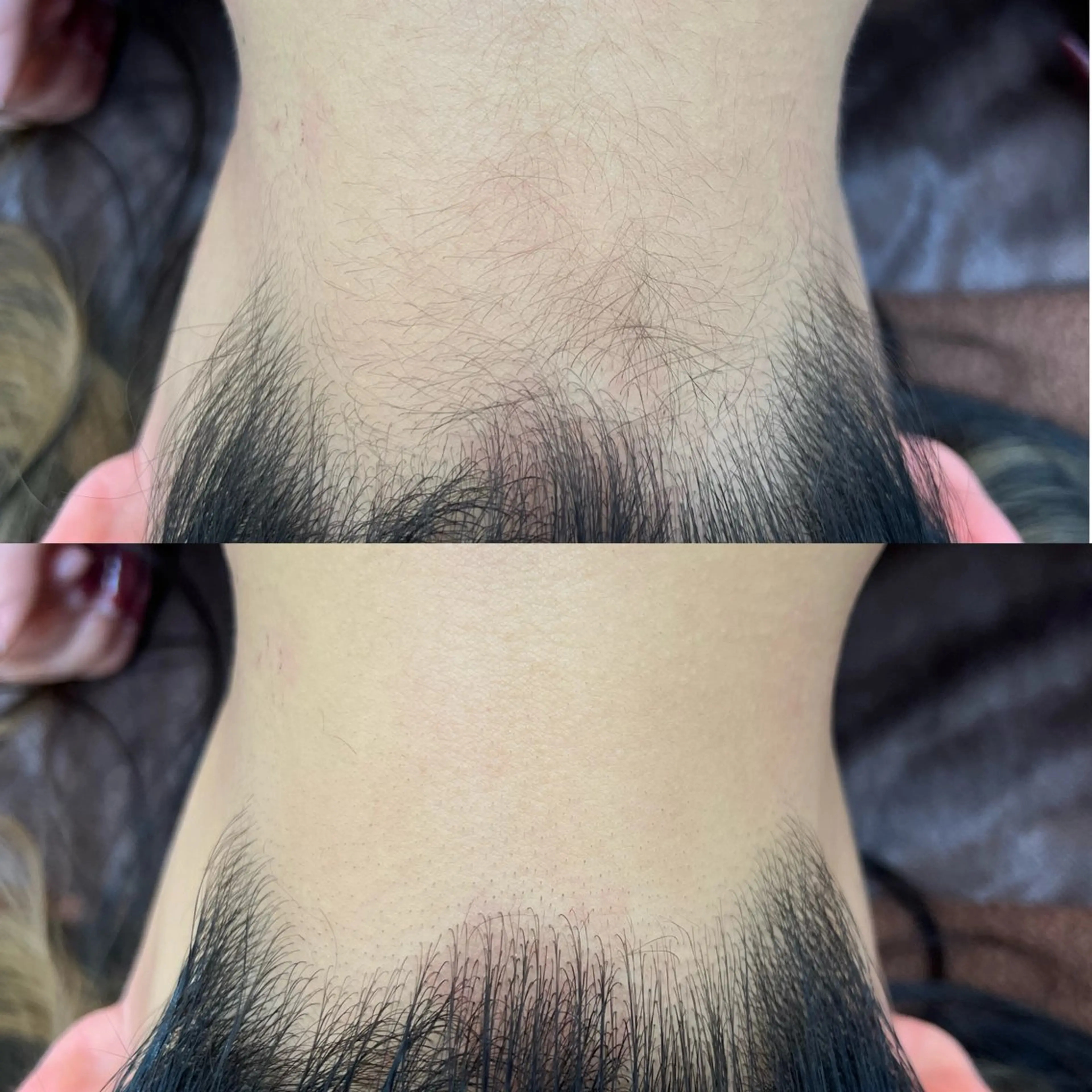 脱毛 プライベートサロン リプレイスのエステ・リラクイメージ