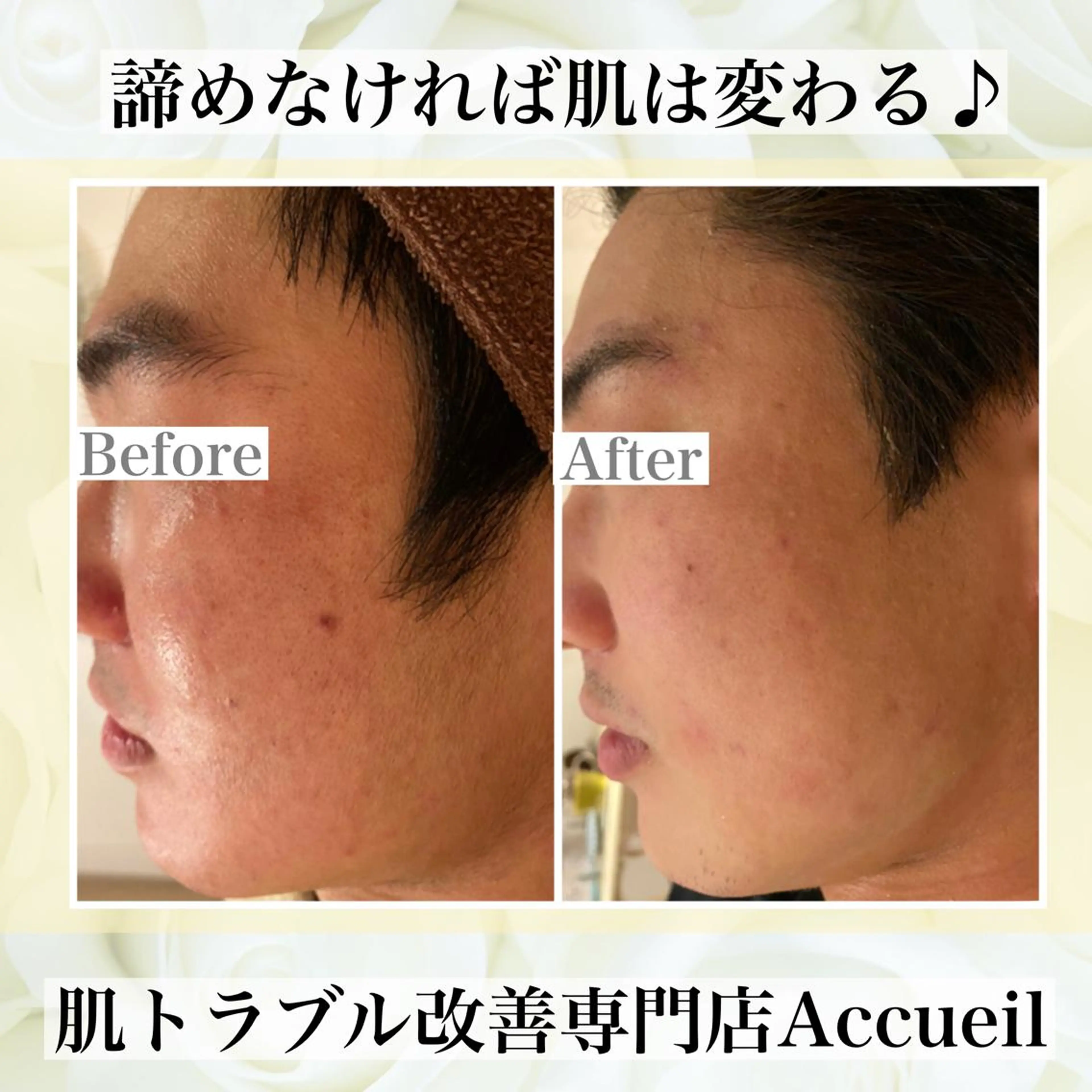 ミディアム カラー パーマ ヘアアレンジ メンズ キッズ ネイル マツエク・マツパ エステ リラク ニキビ・肌質改善専門 ♡人生が変わるサロンのエステ・リラクイメージ