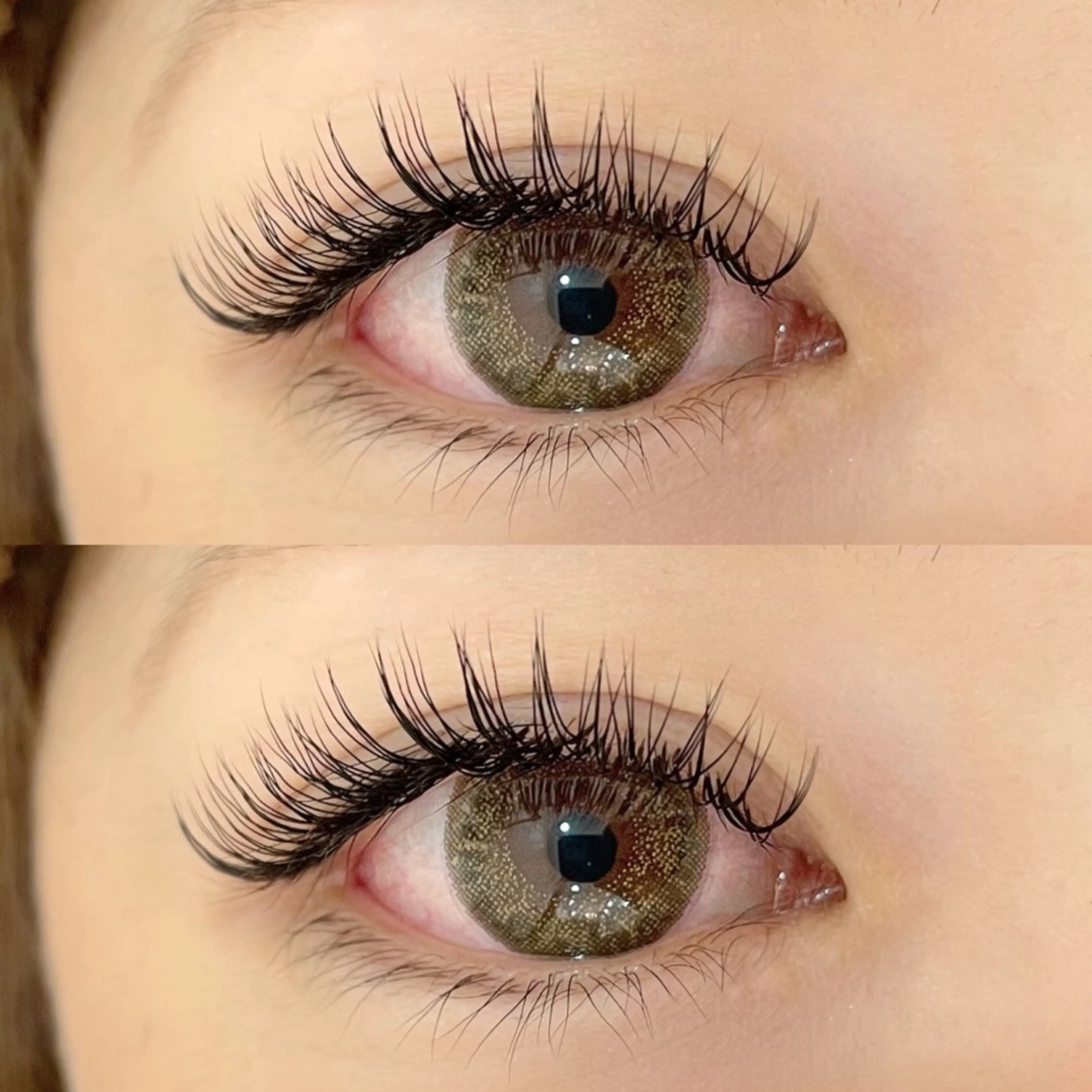 フラットラッシュ100本の写真