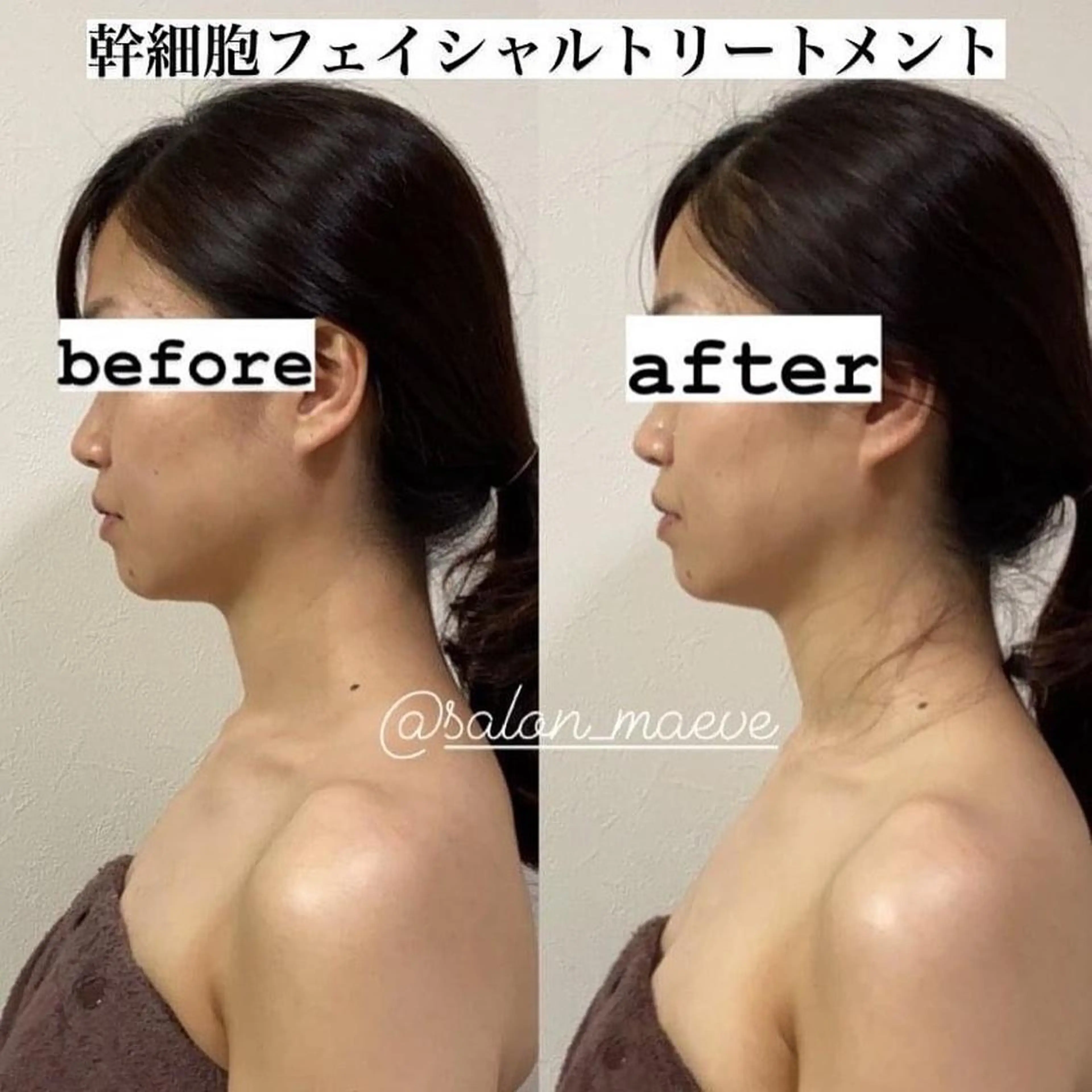 【フェイシャル／エイジングケア】若見え肌に整えるフェイシャルトリートメントの写真